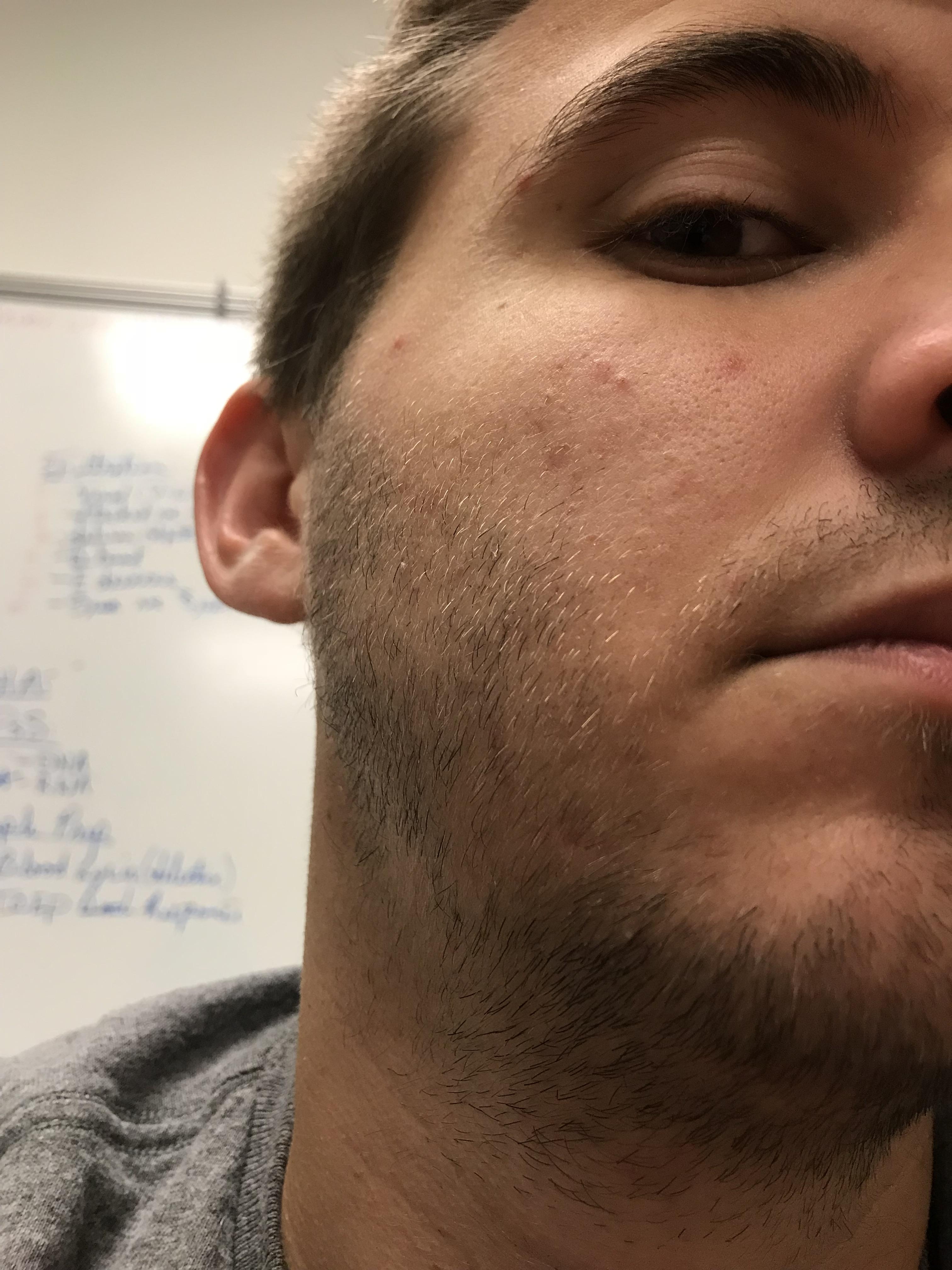 I didn’t have these small, blonde hairs in my beard before. If they all