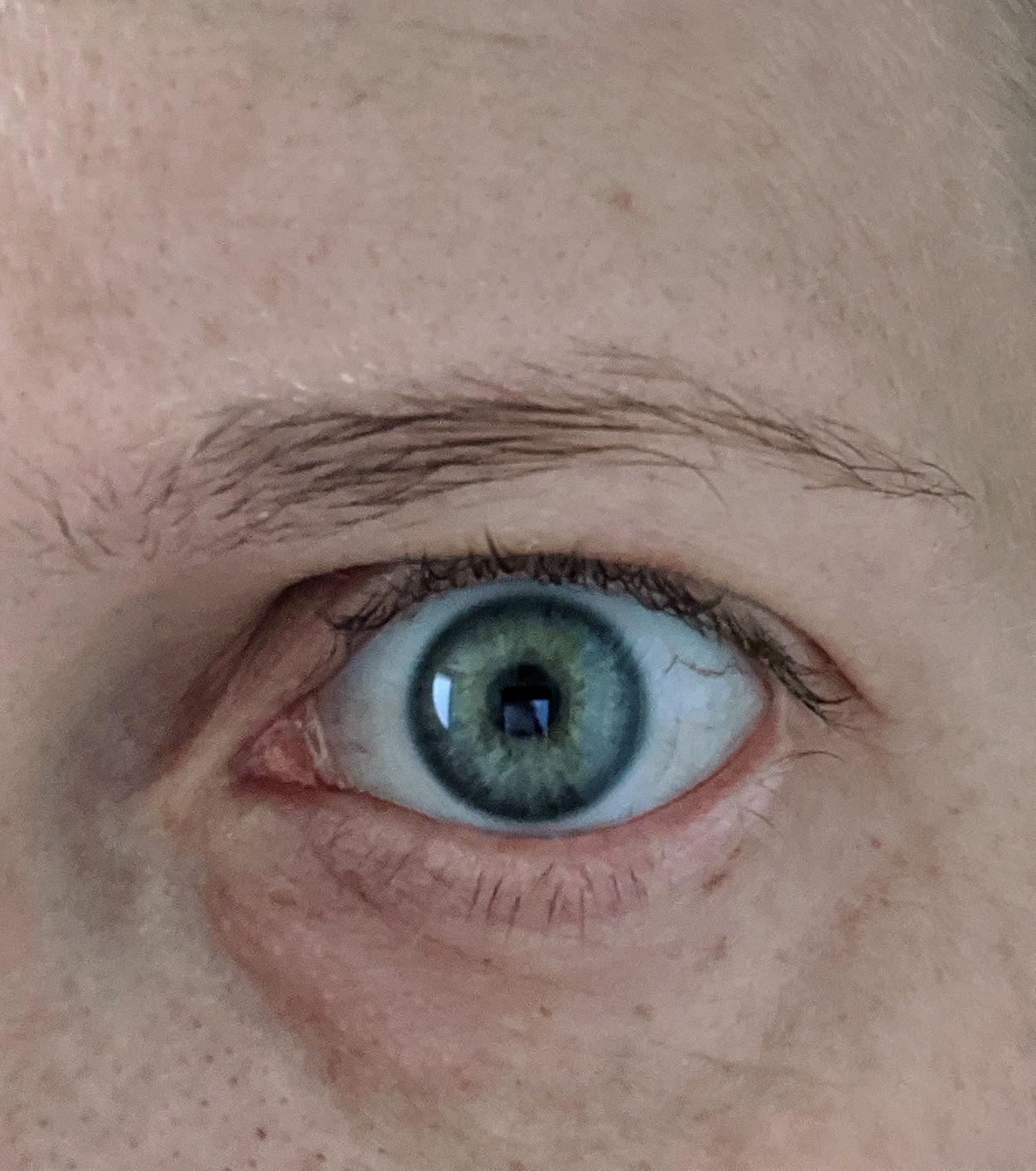 [Skin concerns] early 30s and have noticeable baggy eyes. What can you