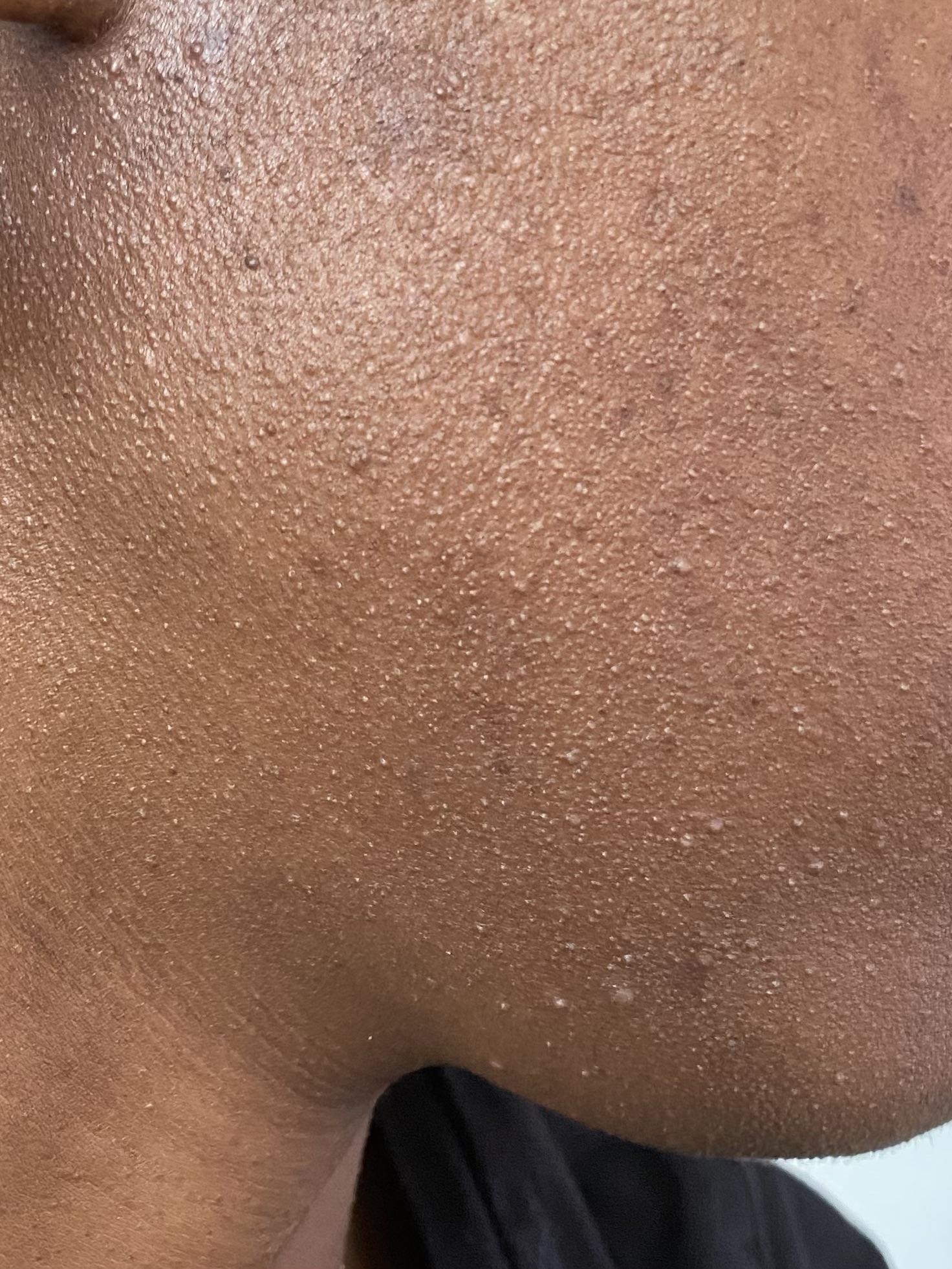 dhc cleansing oil Reddit post and comment search SocialGrep