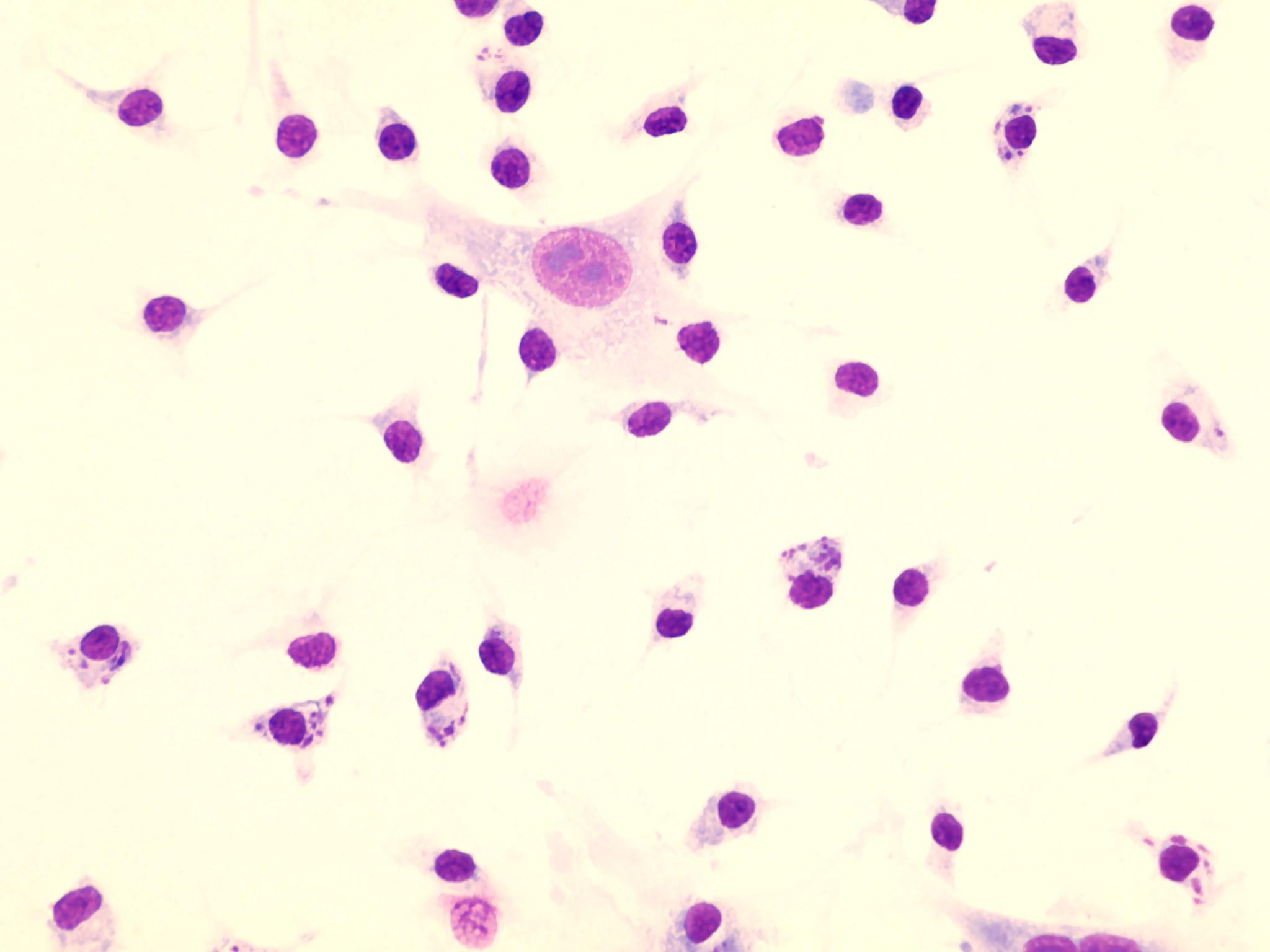 Macrophages infected with the parasite Leishmania donovani (the smaller