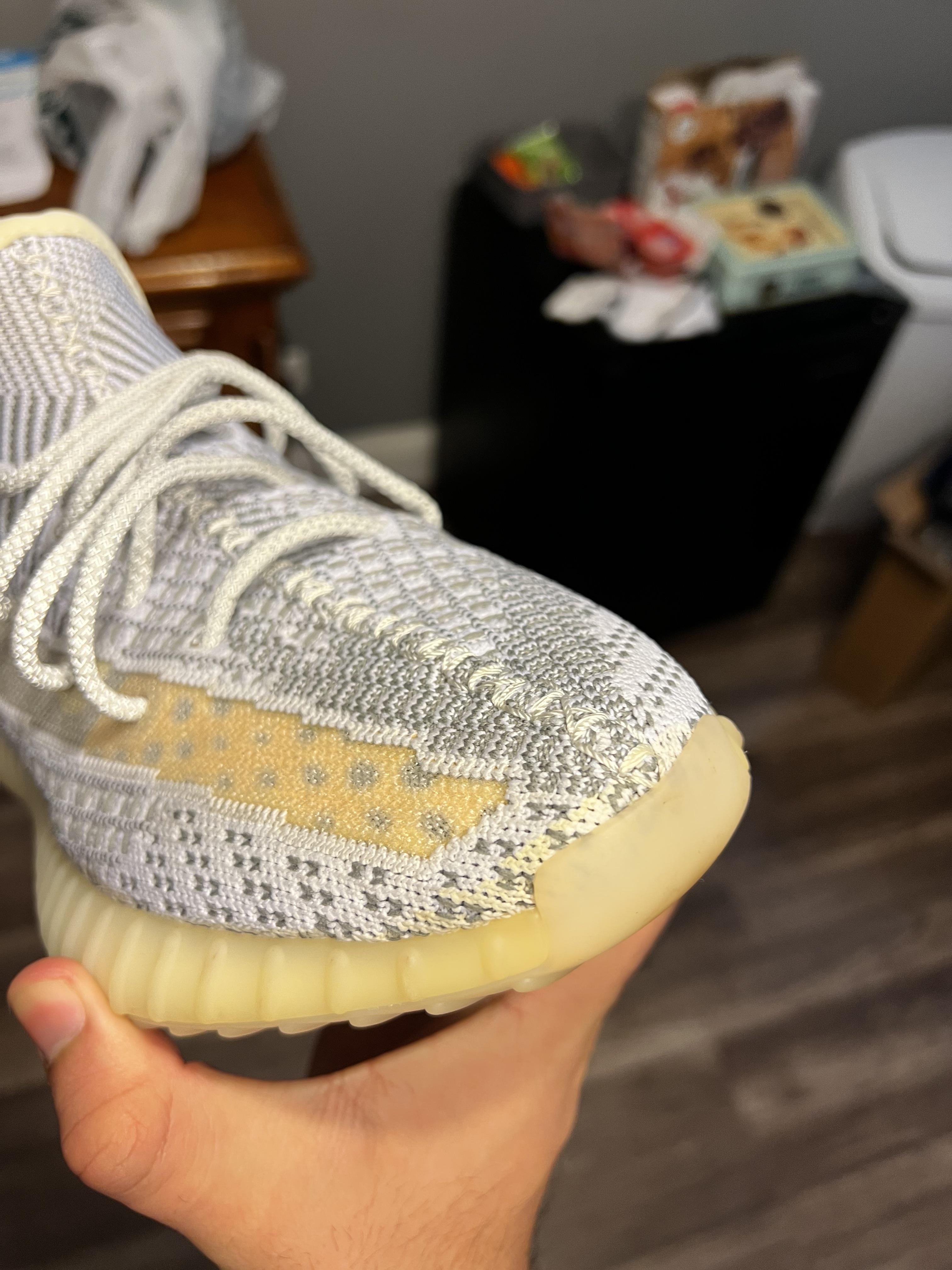 Yellowing all over my statics ( r/yeezys