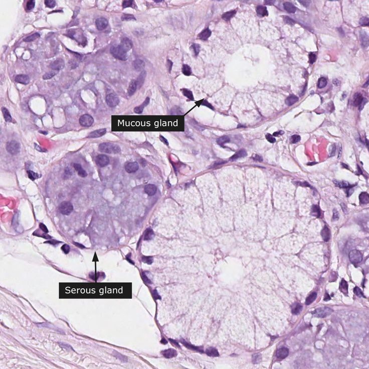 Serous versus mucous gland r/Histology