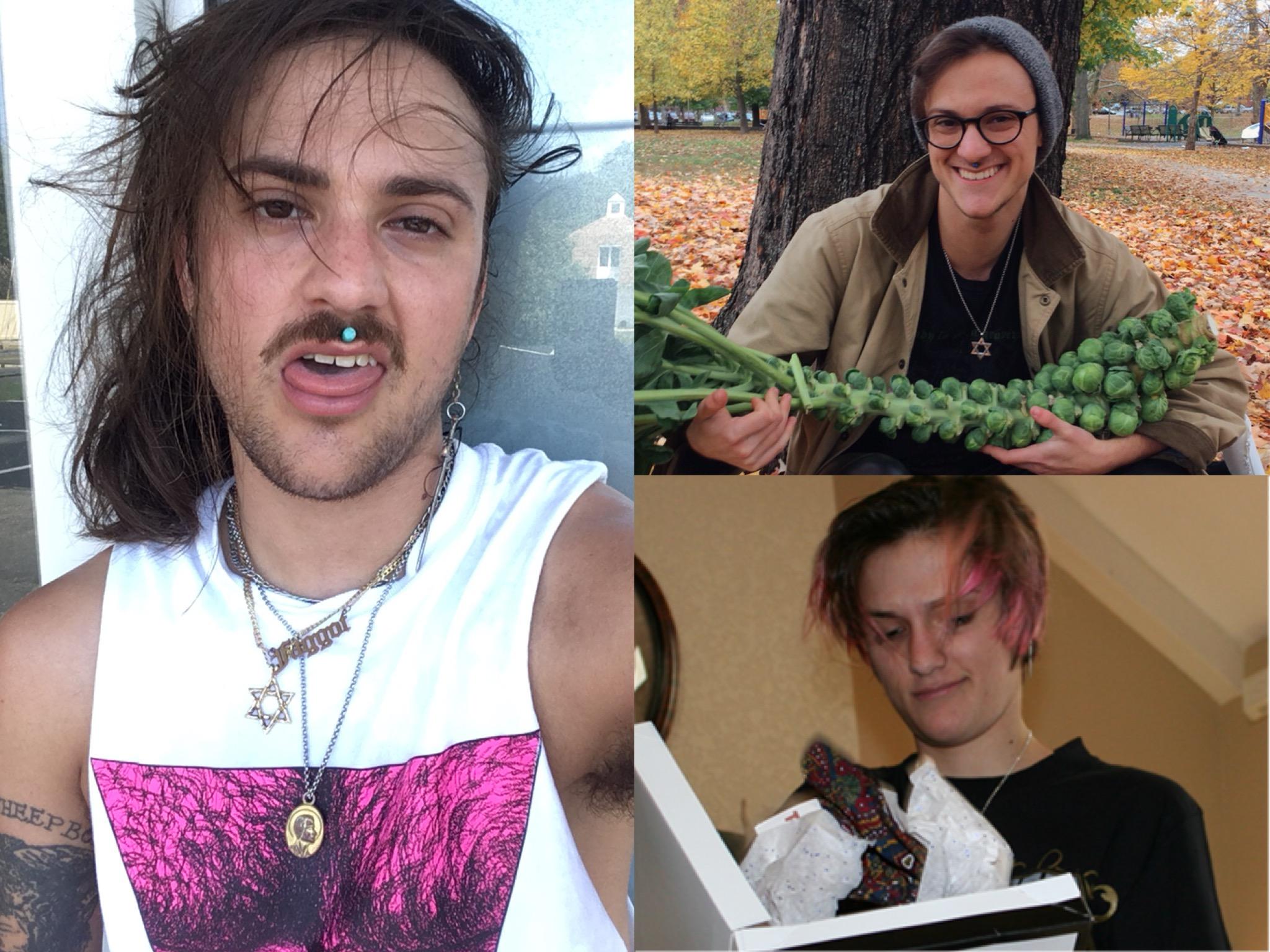 Ftm Transition Bottom Surgery