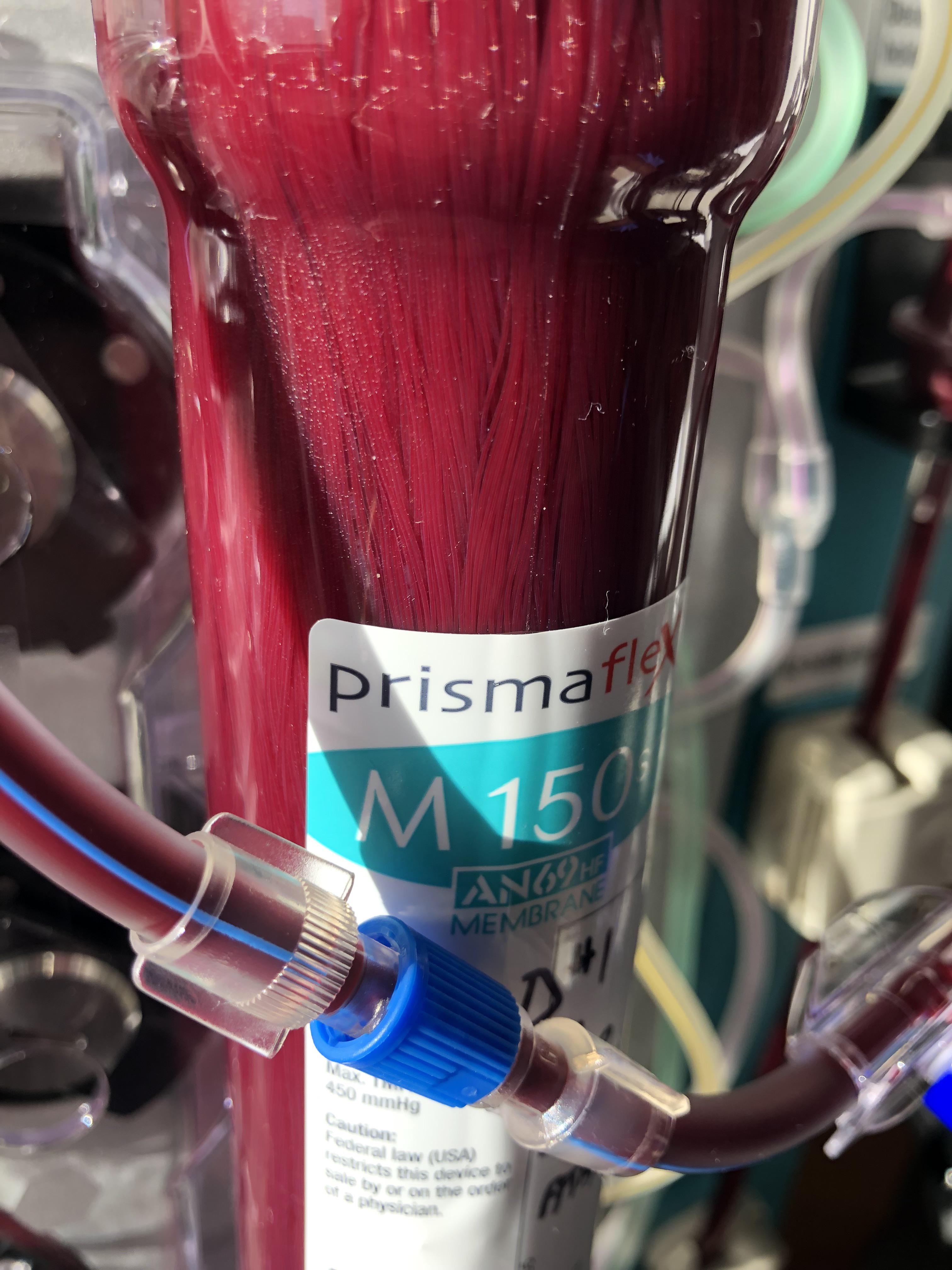 A cool view of the CRRT filter I was using the other day. r/nursing