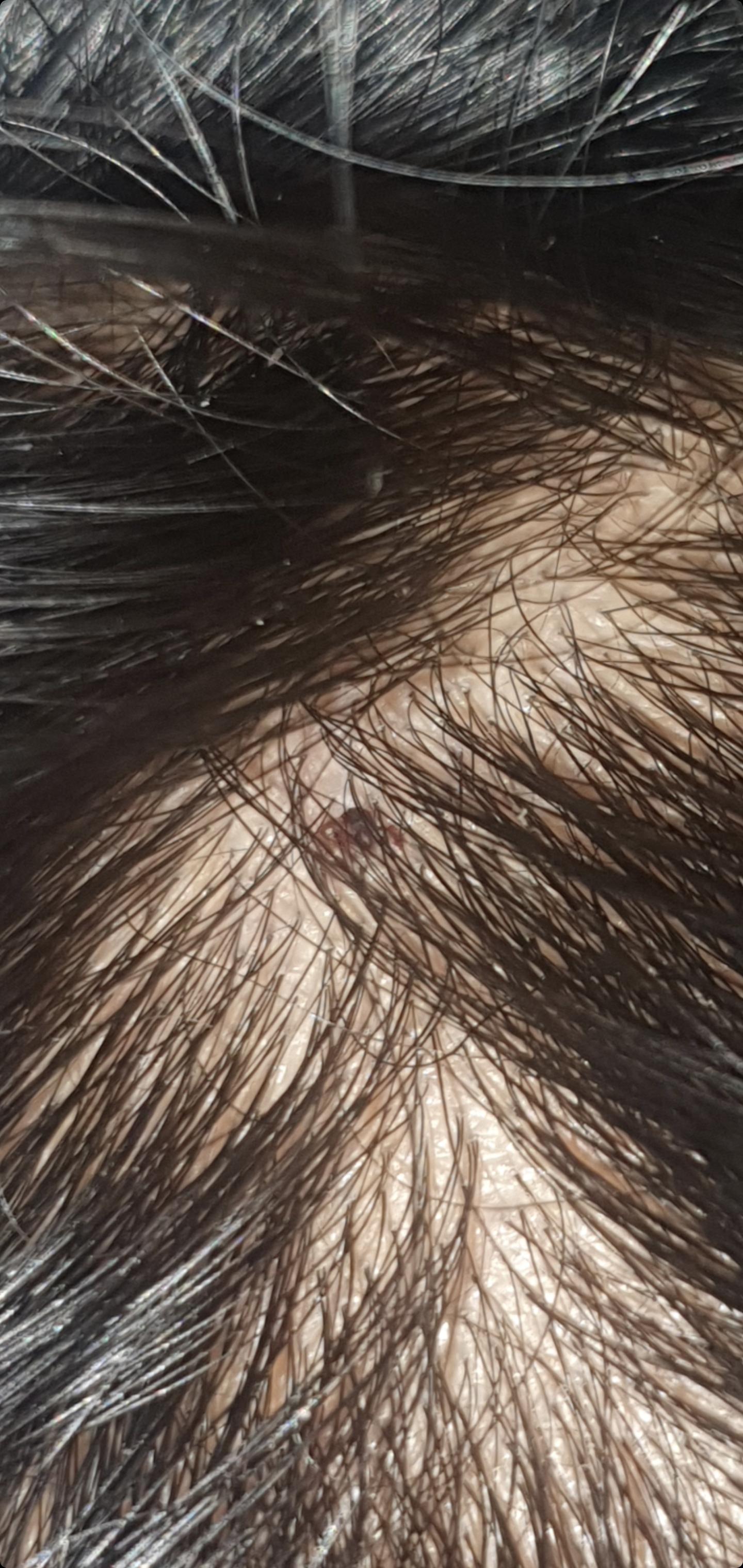 will hair grow back after this wound heals? r/DermatologyQuestions