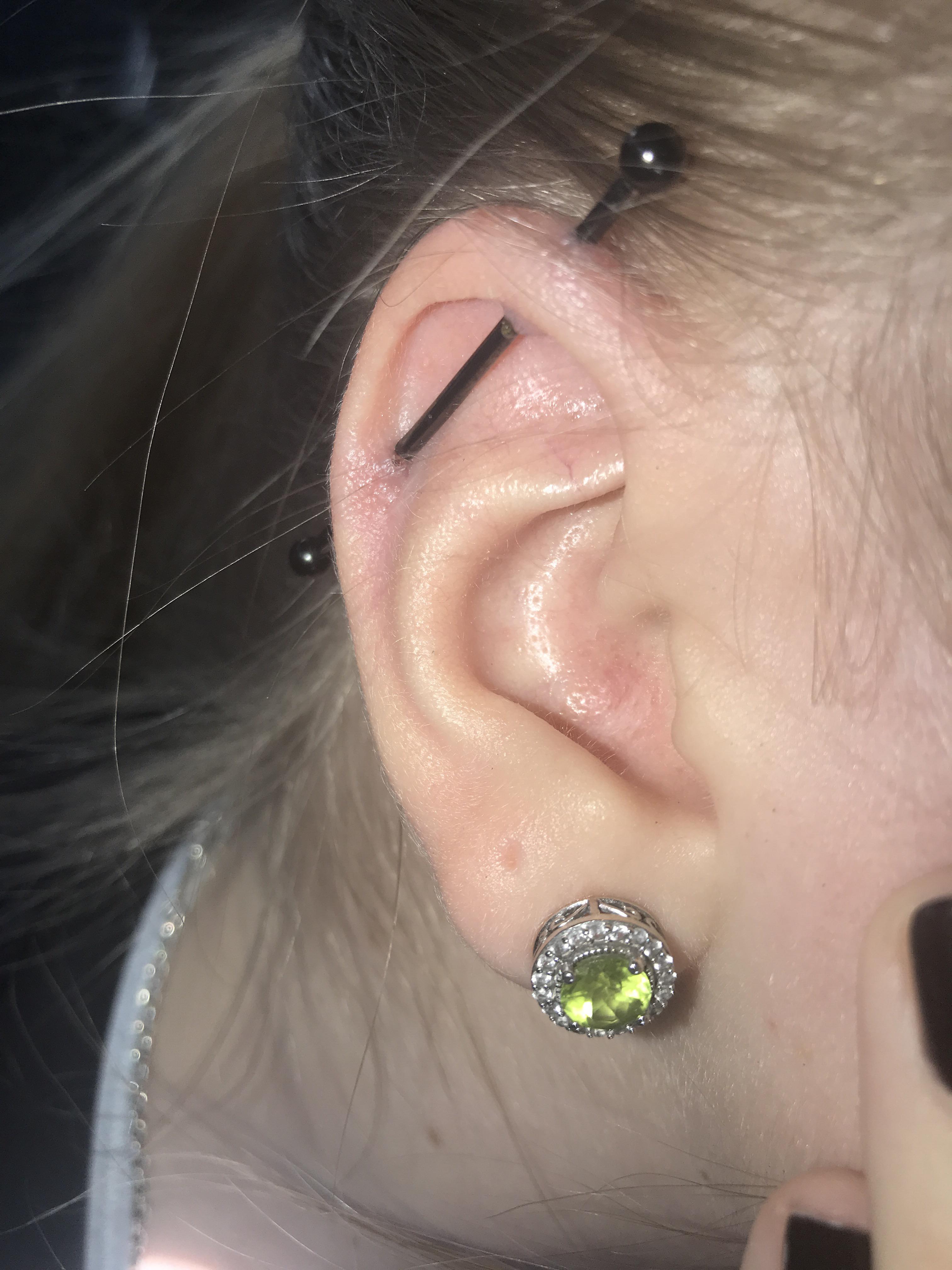 How can I get rid of these bumps? I clean the bar and the ear itself