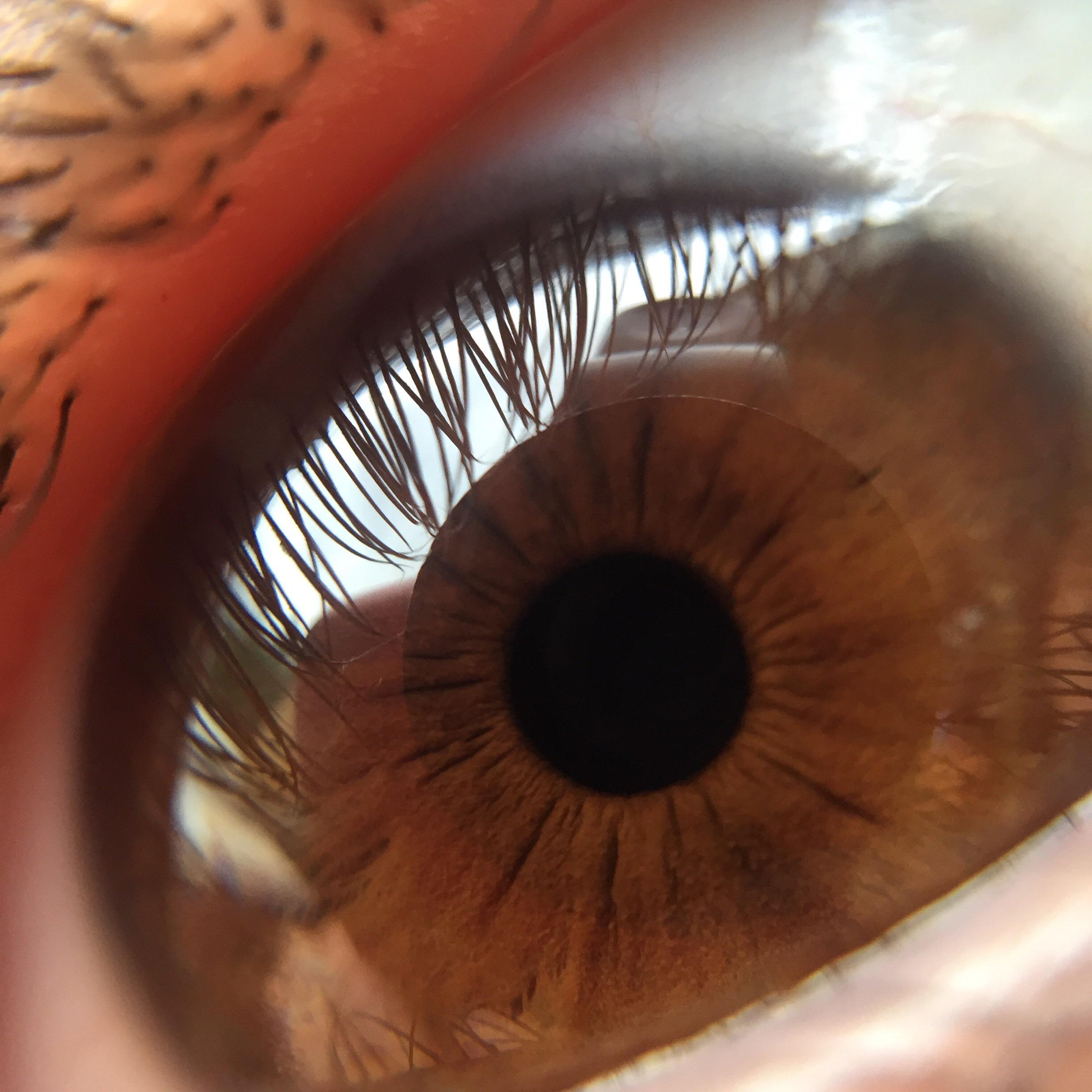 Human eye. Taken with an IPhone camara with a zoom lens r/pics