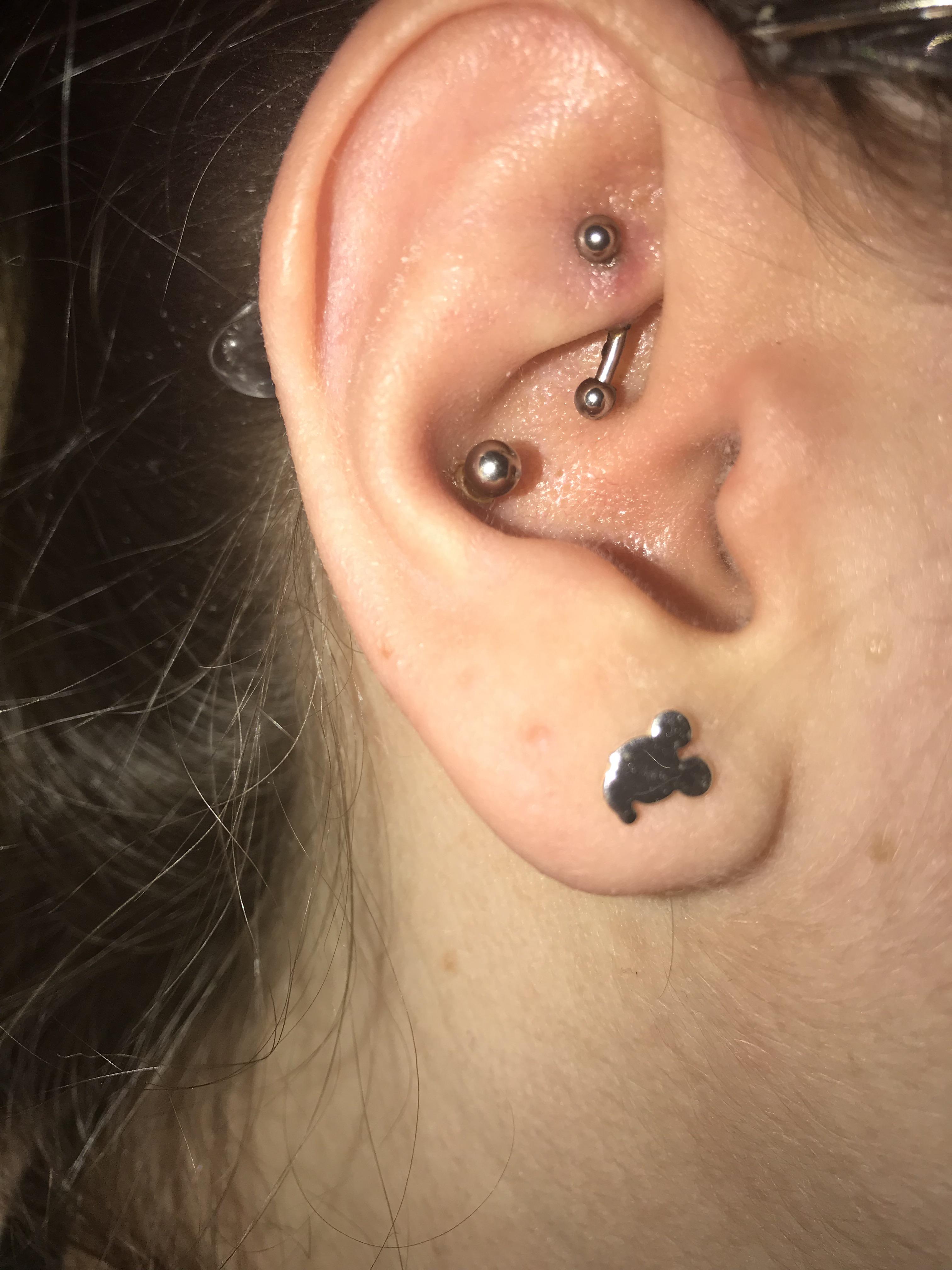 Rook was pierced about 2 1/2 weeks ago, is this amount of swelling