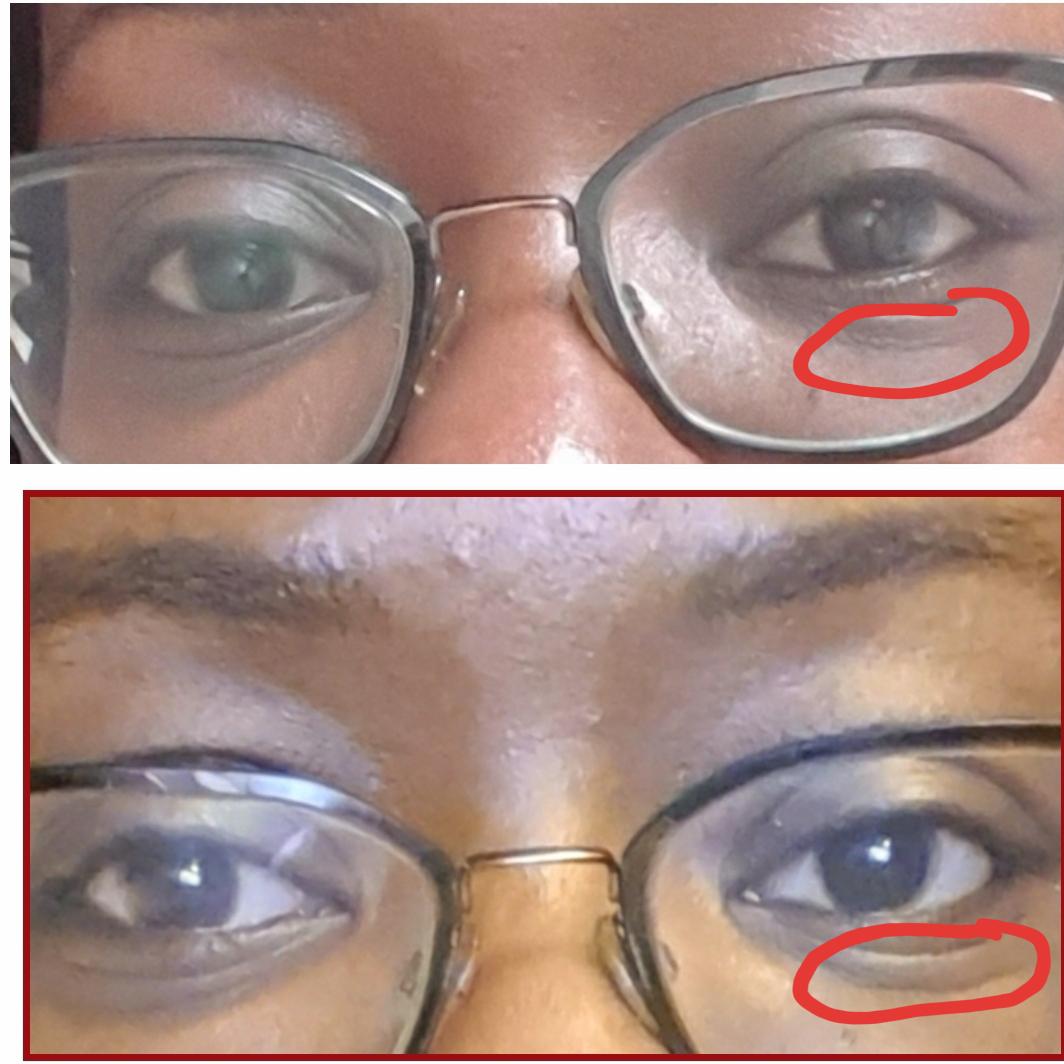 [ROUTINE HELP] Ok so I won't put glycolic acid under my eyes anymore 😭