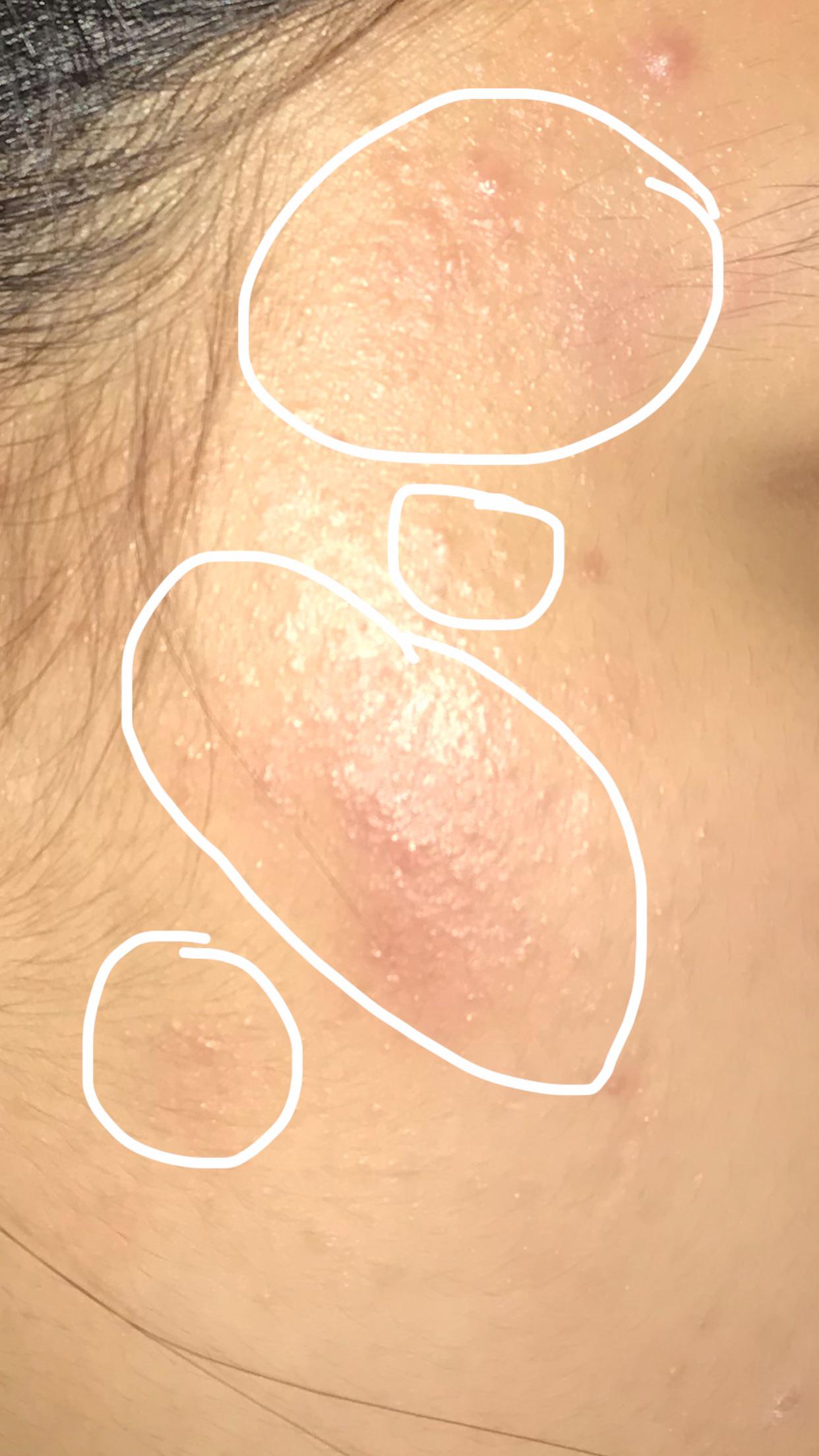 Do you guys have any idea what is this? Or is this a damage skin