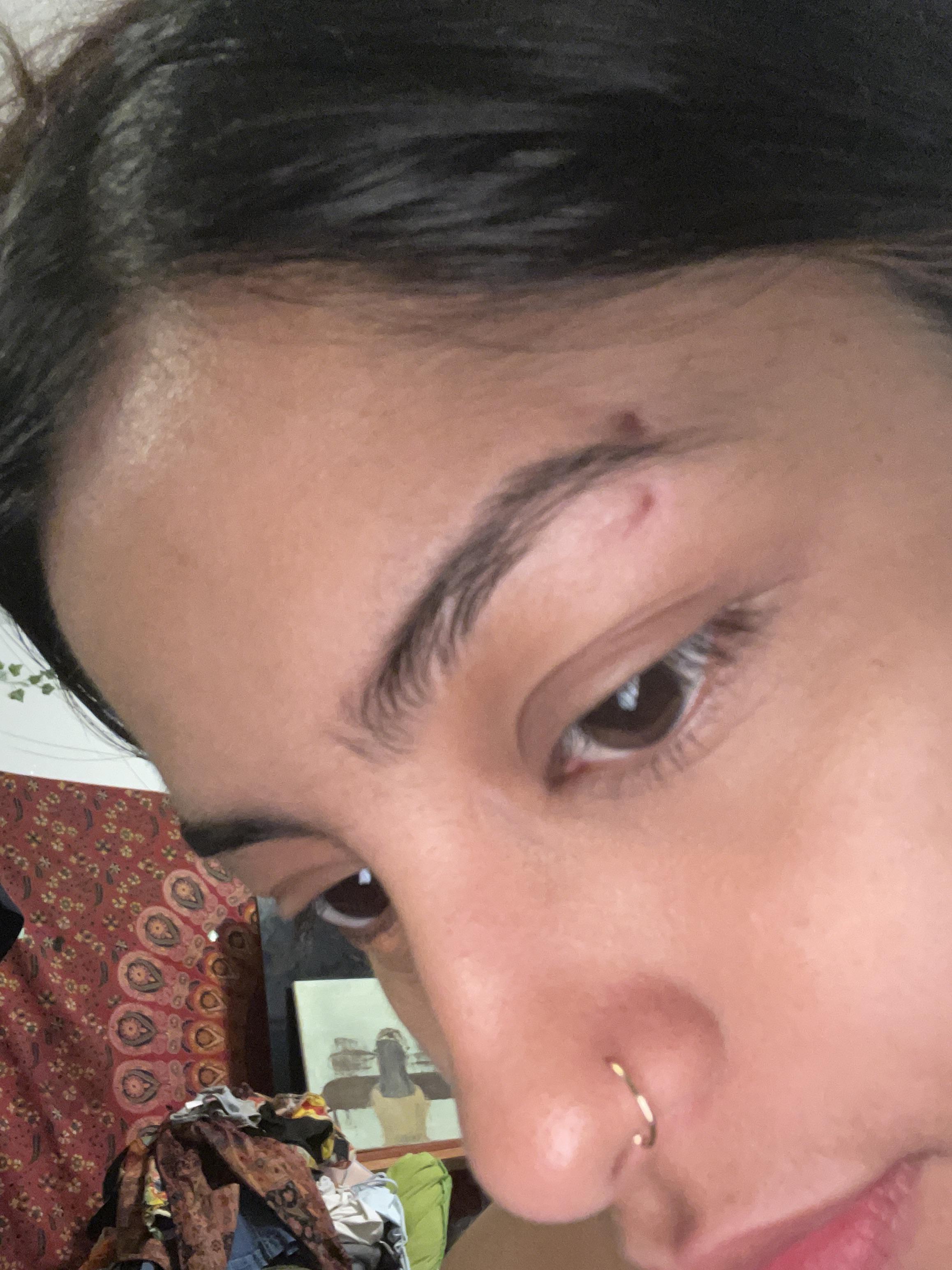 Eyebrow Piercing Scar r/scars