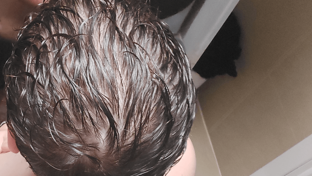 20 male is it just me or my hair looks really thin when it s wet r