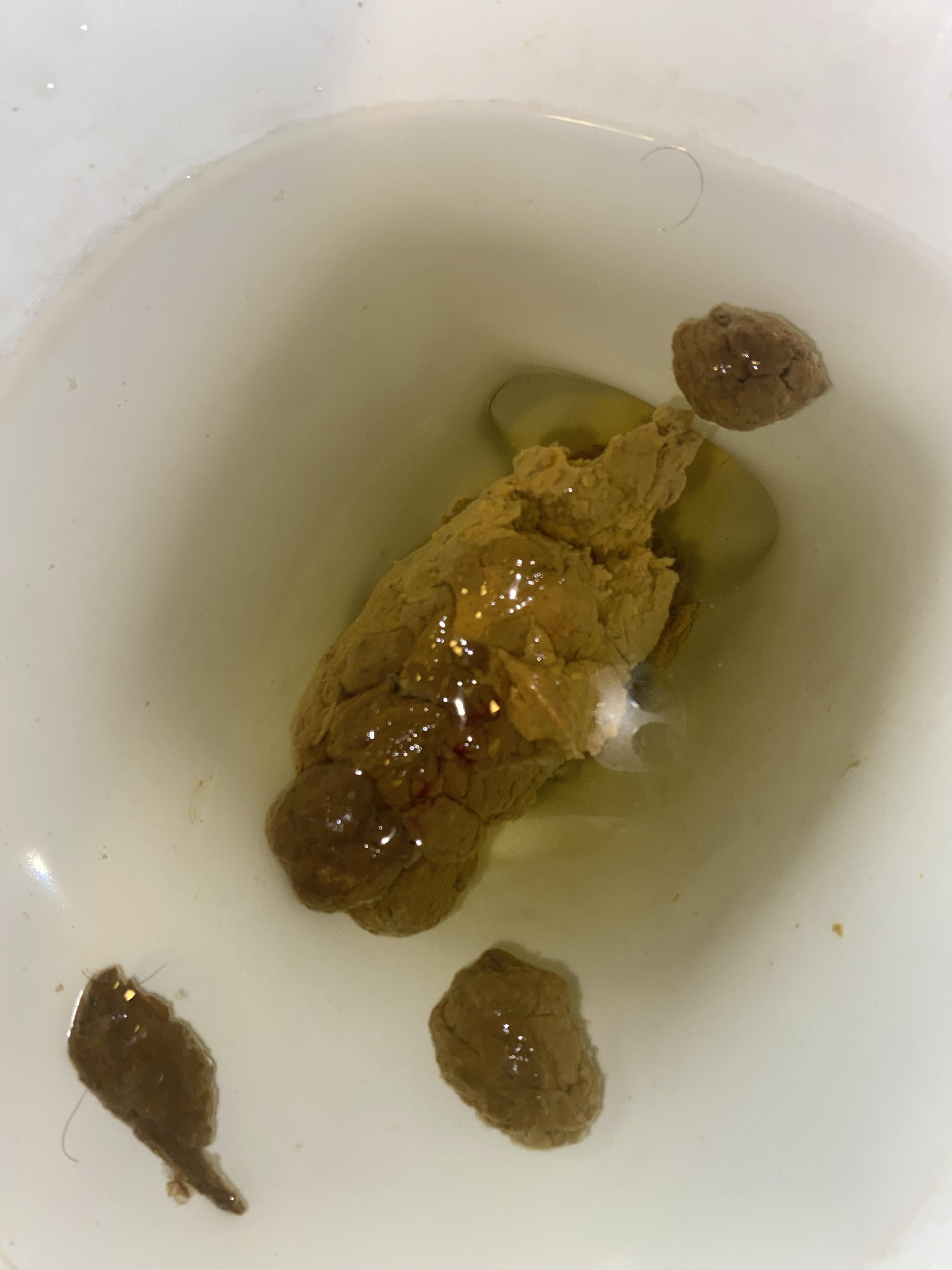 There’s a little streak of blood and this is my first time, what should