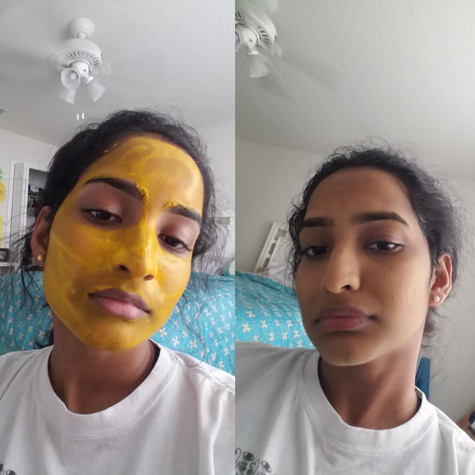 99 best Stained Skin images on Pholder Skincare Addiction, Makeup Addiction and Mildlyinteresting