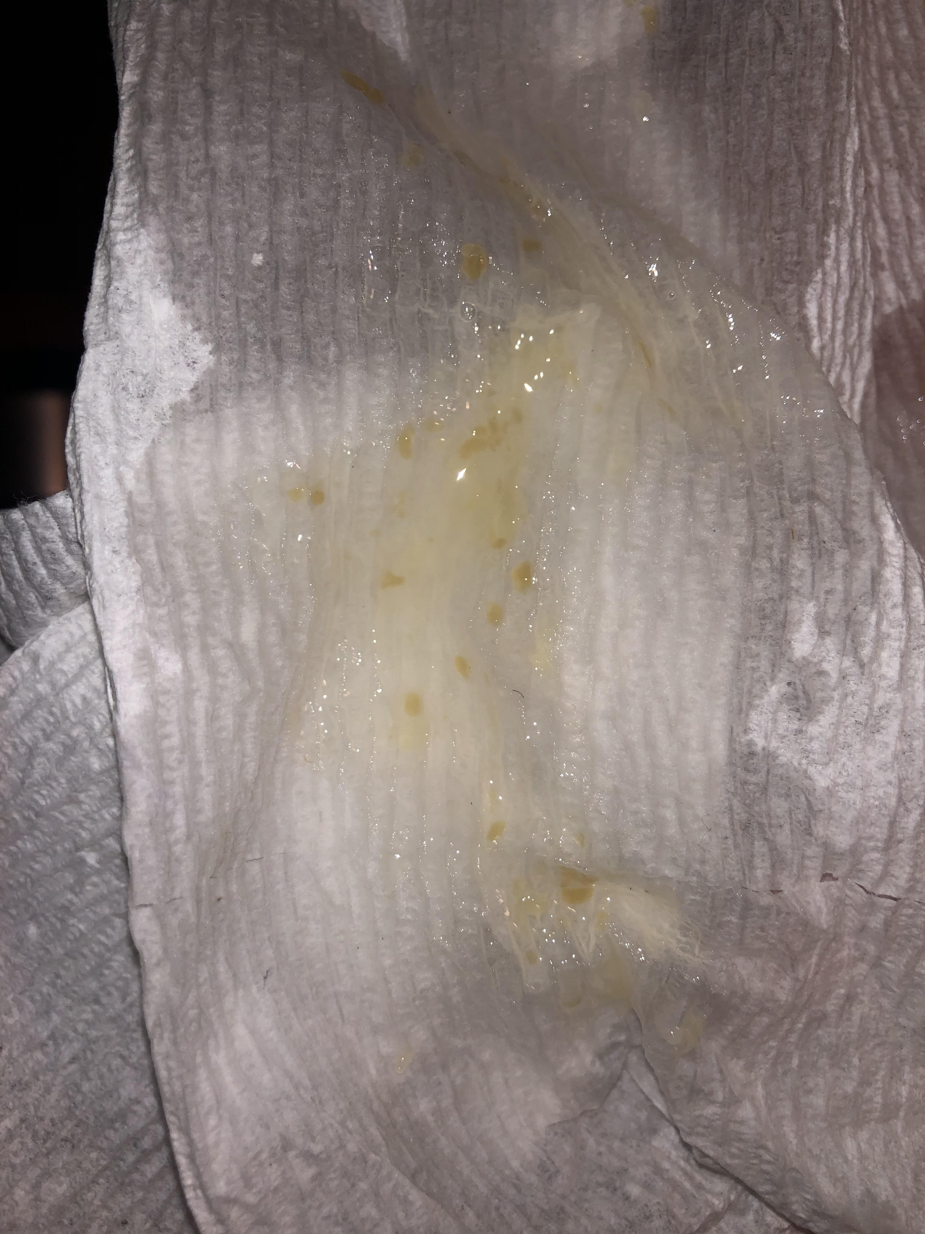 23 year old male, yellowish spots in semen. Picture attached, thanks in