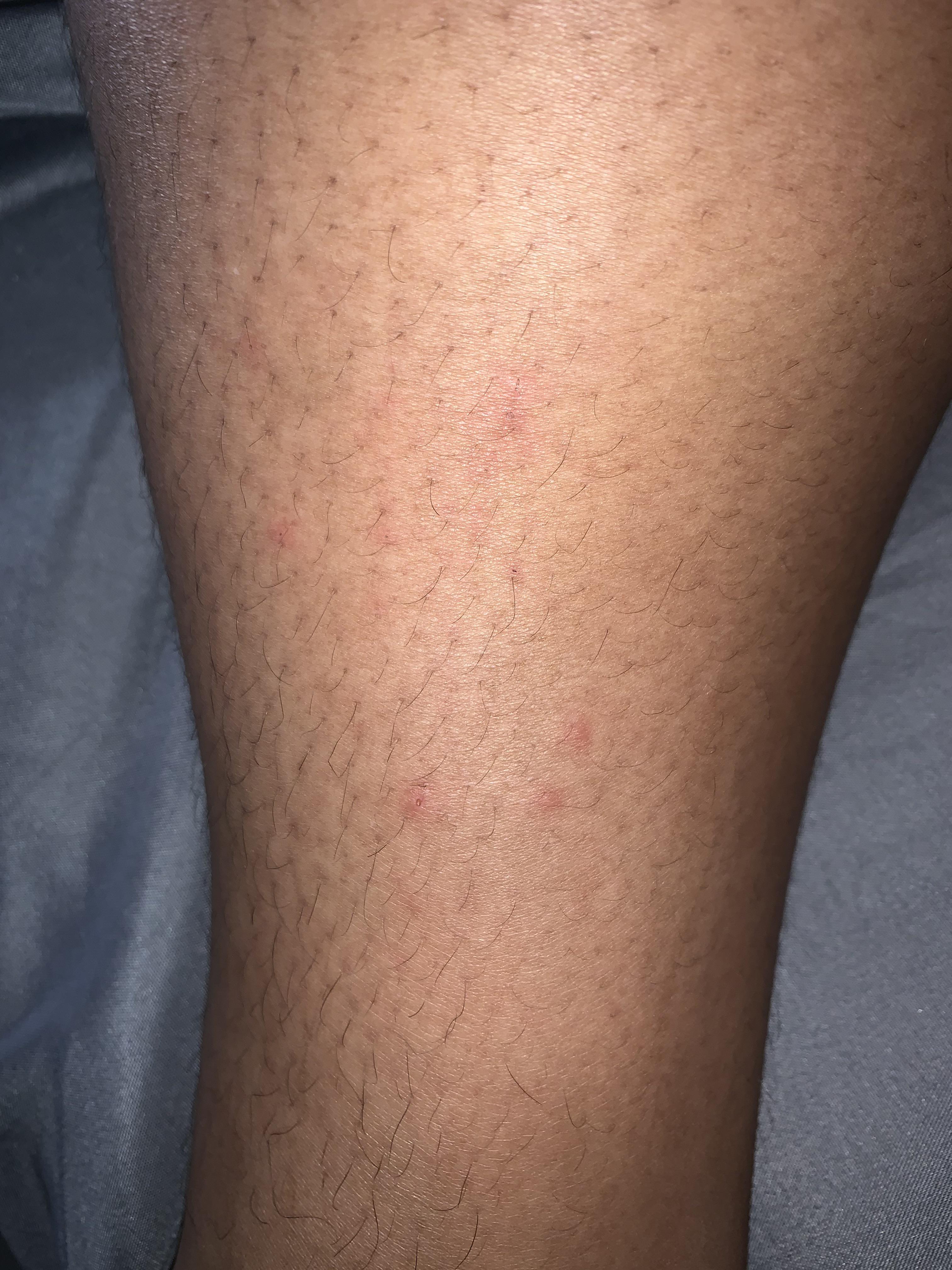 I've been waking up with itchy bites the last few days. Could these be