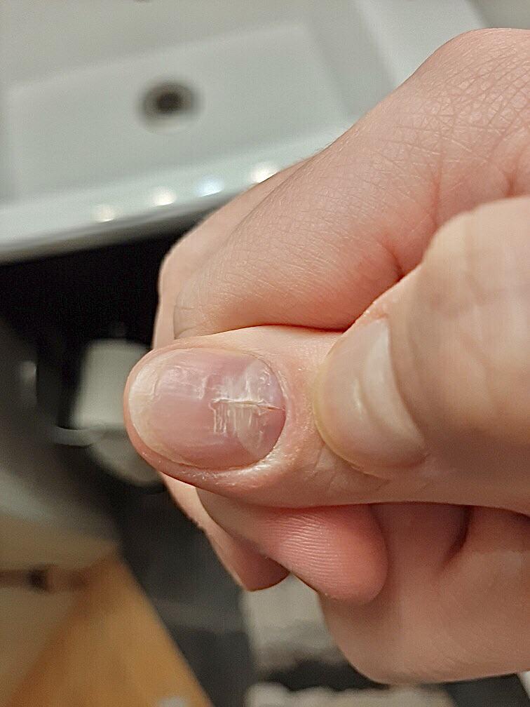 Does anyone know what this is? It’s splitting down the middle of the