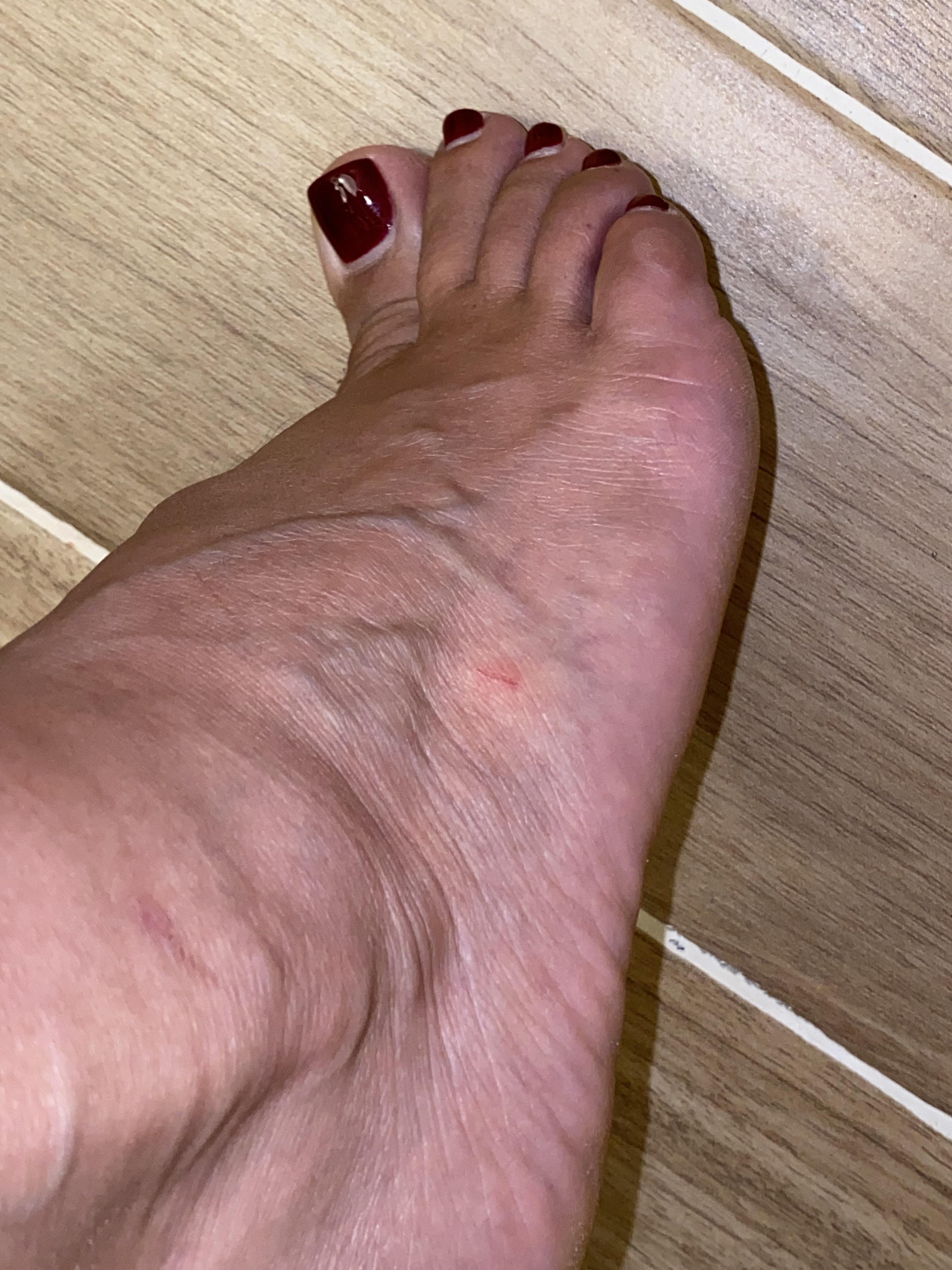 Could this be a cat bite? Or is it definitely a scratch. I was having