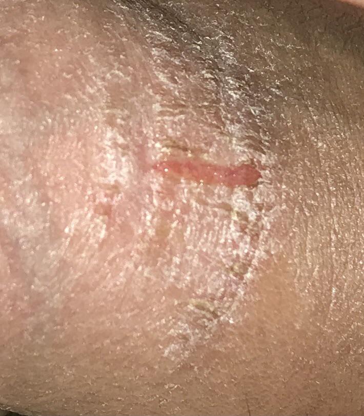 [help] there’s a weird scratch along with some white strips that look