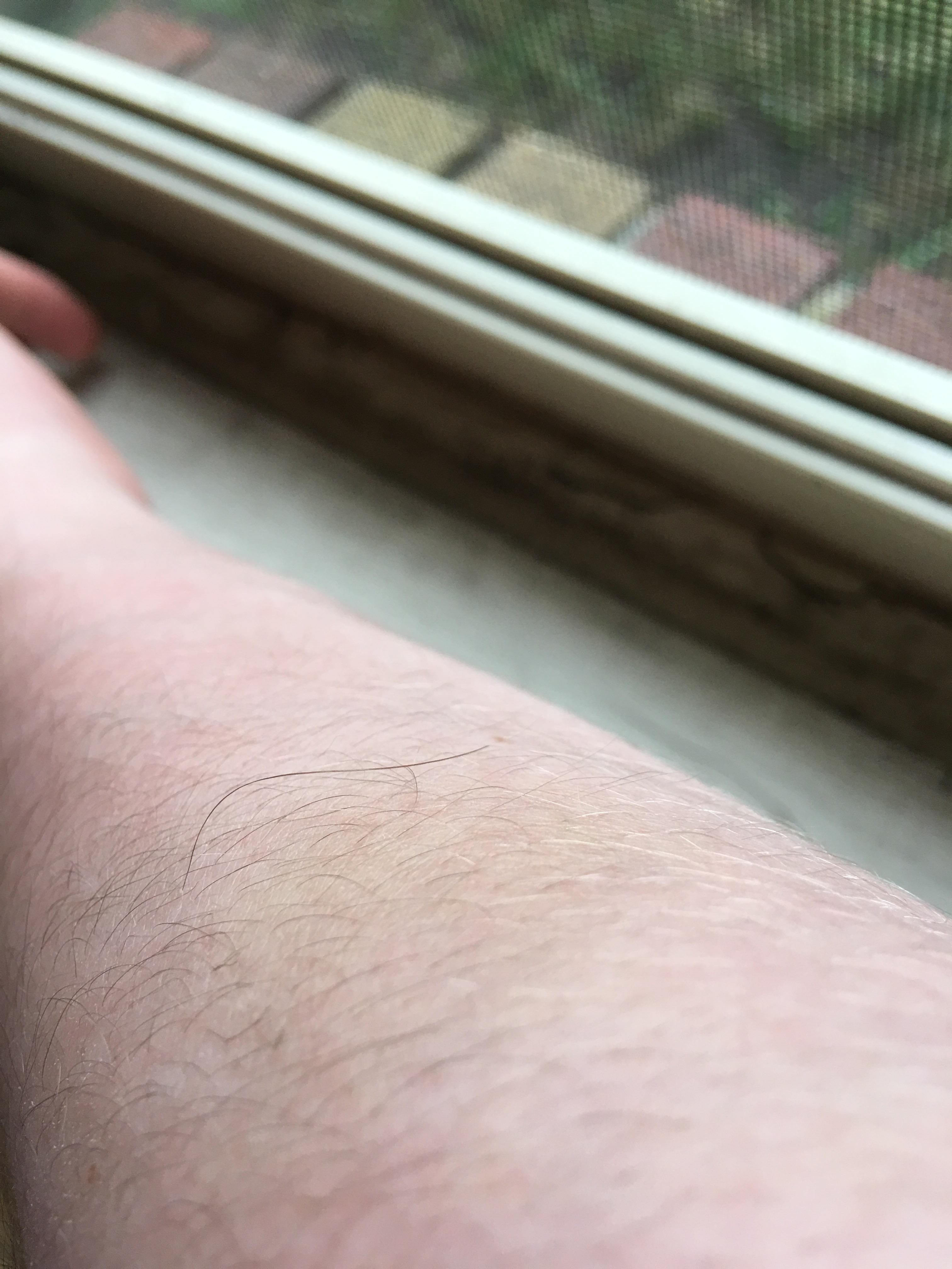 My brother has a hair on his arm that’s significantly darker and longer