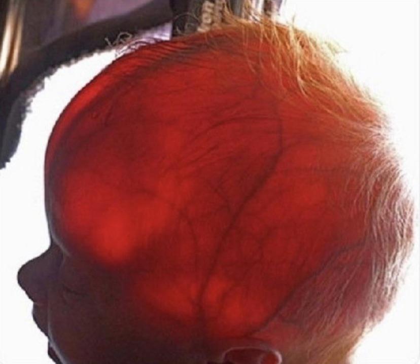baby head in bright light r/WTF