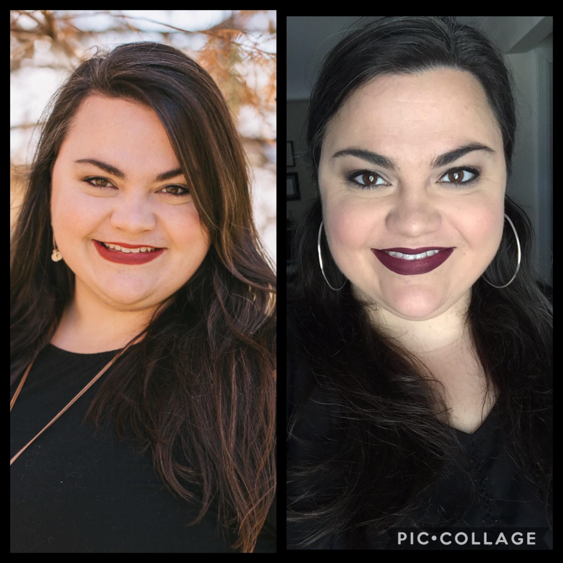 Weight Loss After Gallbladder Removal Reddit WeightLossLook