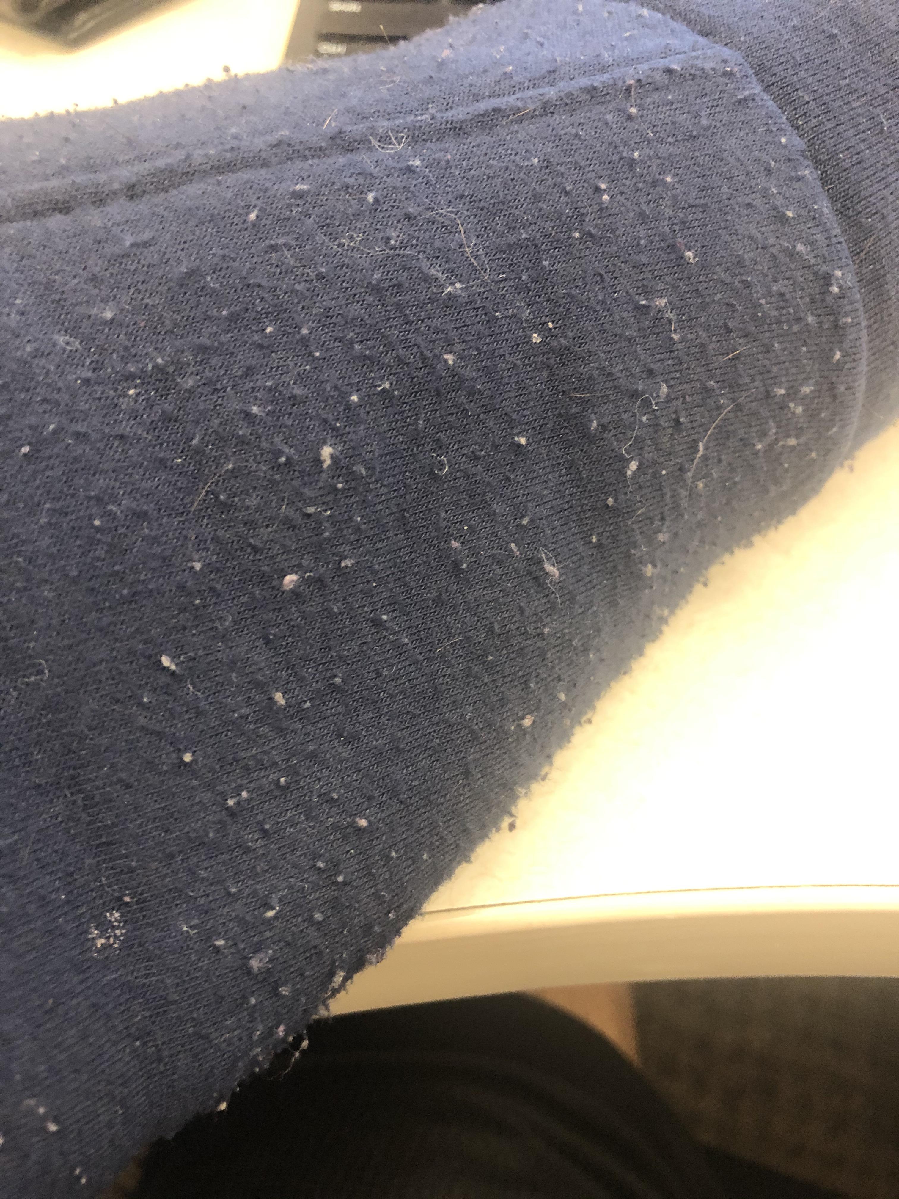 How do I get rid of these pieces of Lint? A lint roller won’t work. r