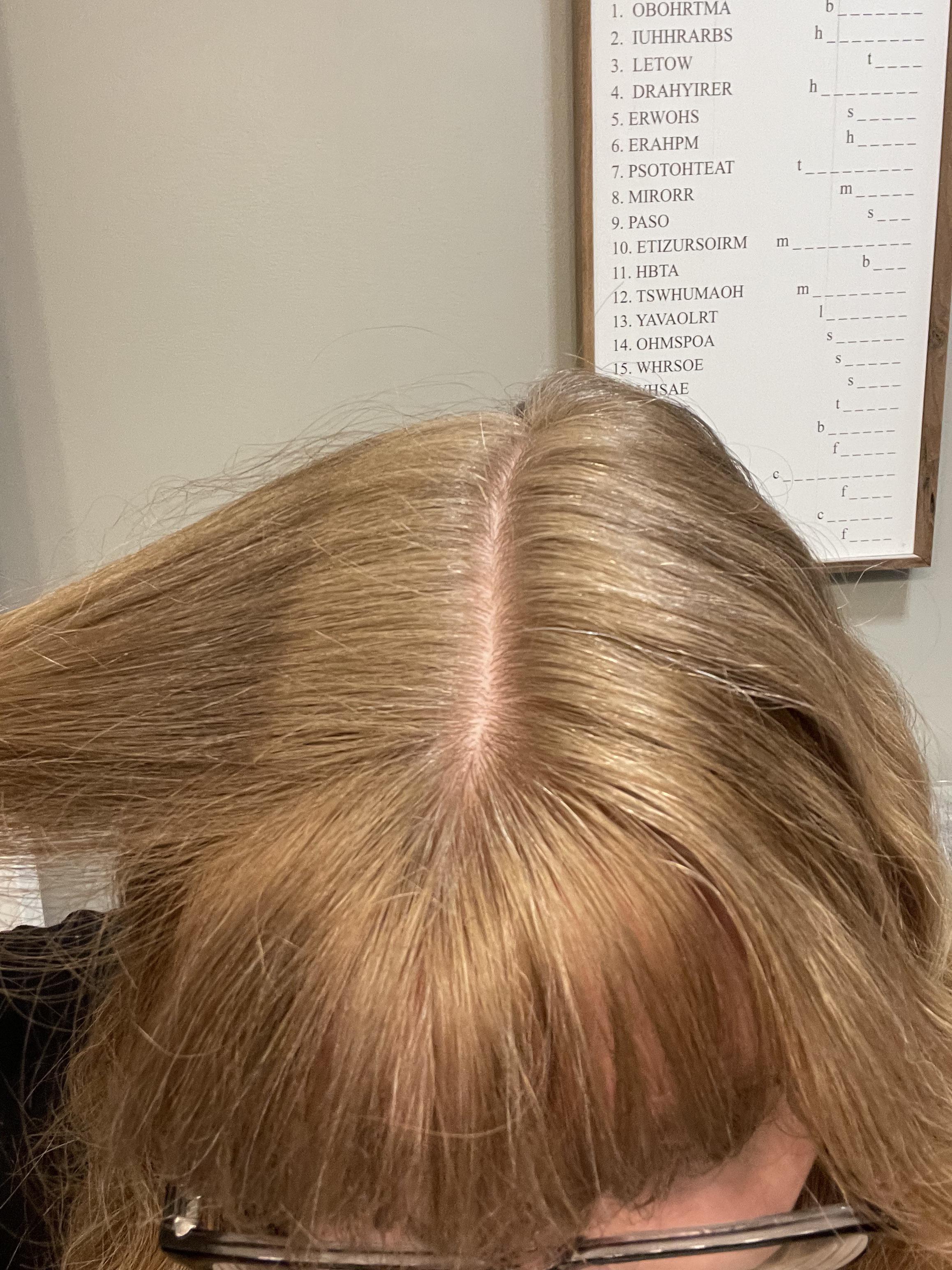 Hair got darker during pregnancy? r/beyondthebump