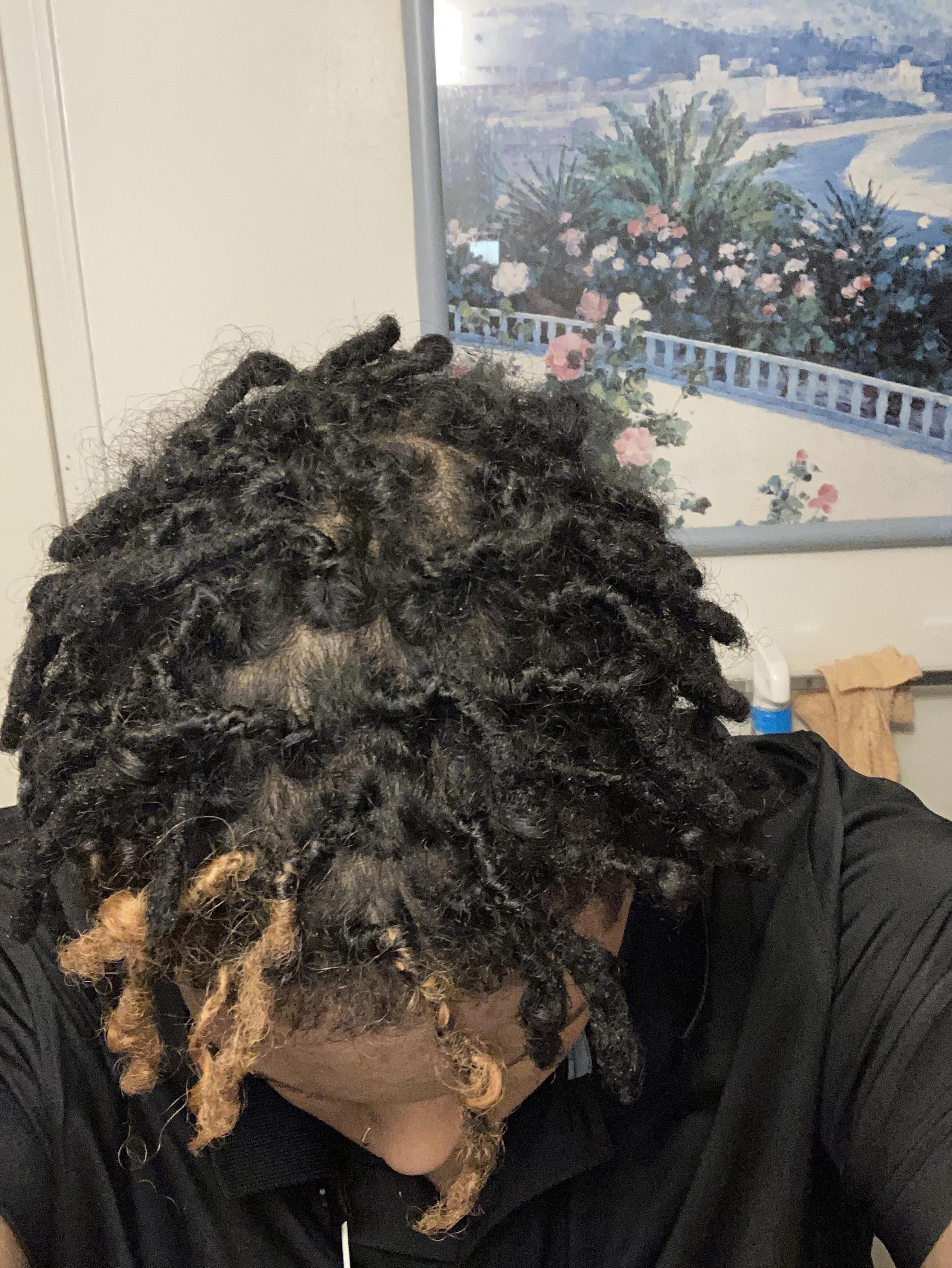 2 Month dread journey. How’s it looking? this ugly stage is tragic lol
