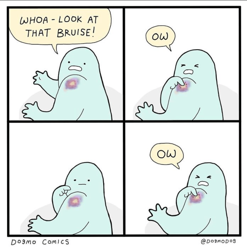 Weird bruise? Maybe r/weirdbruises