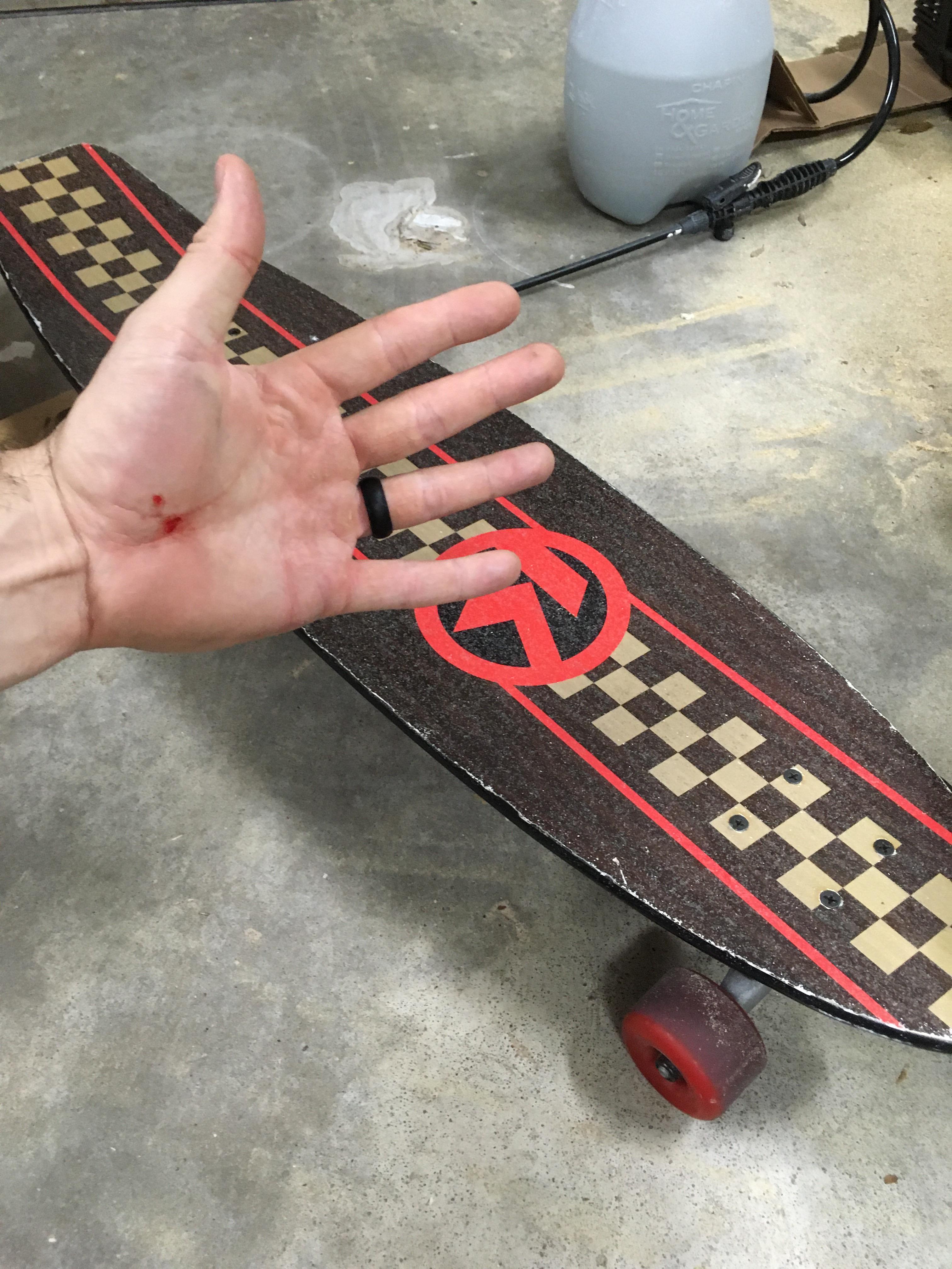 Wheel bite is real r/longboarding