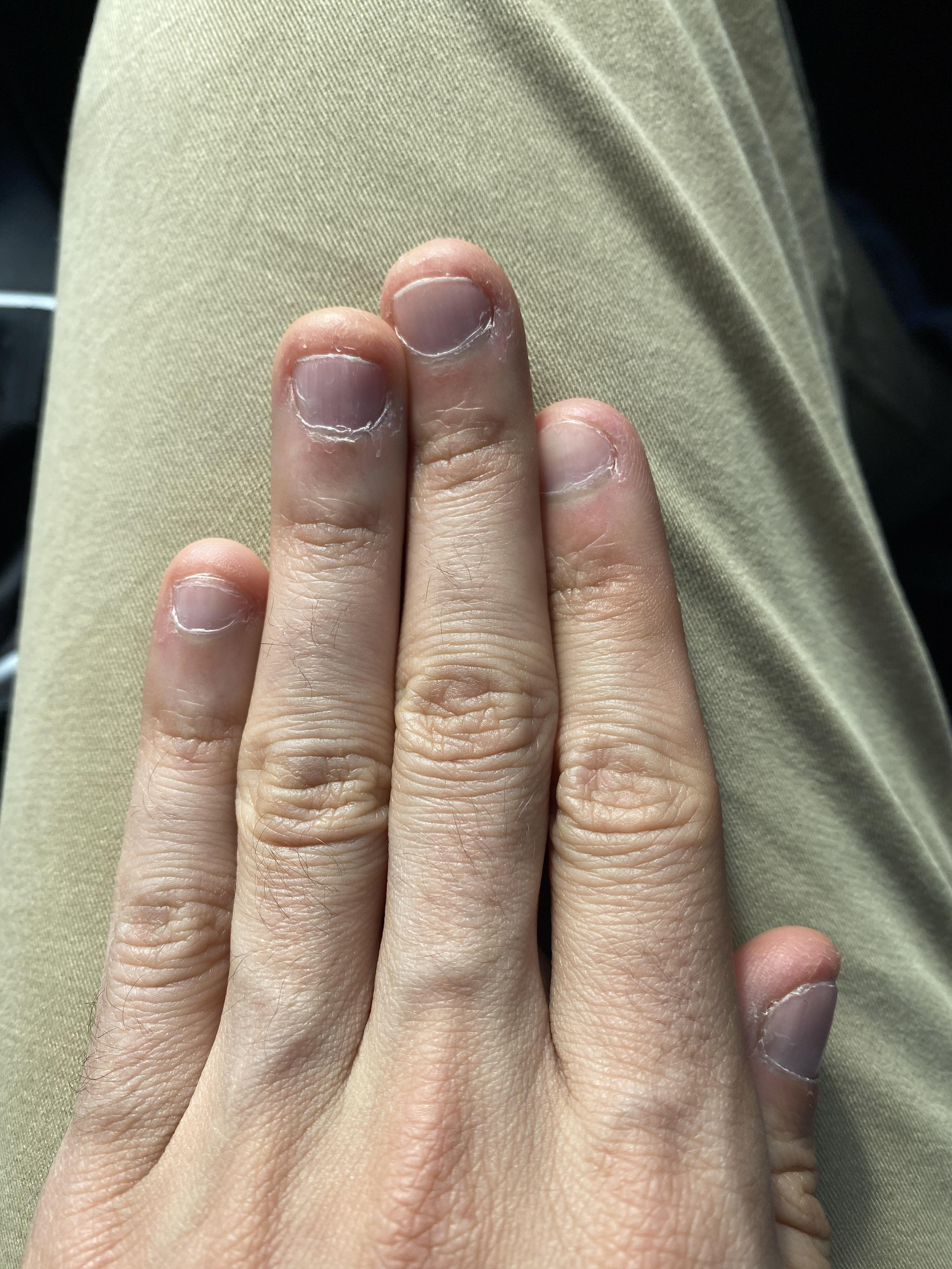 2 months of growth! My nails look yellow because I have kept them