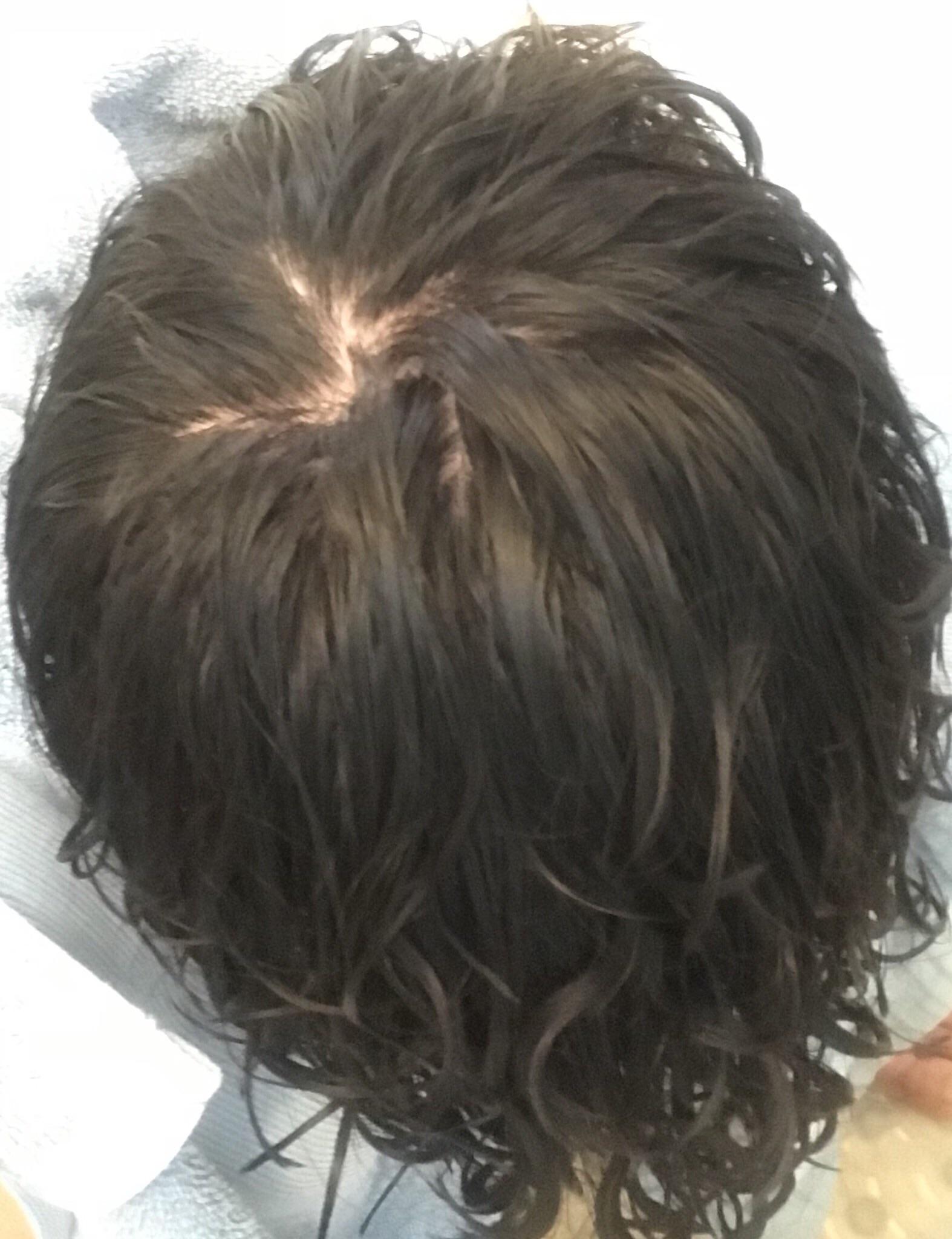 Is my hair thinning? I lose 50150 hairs a day in the shower r/malehairadvice