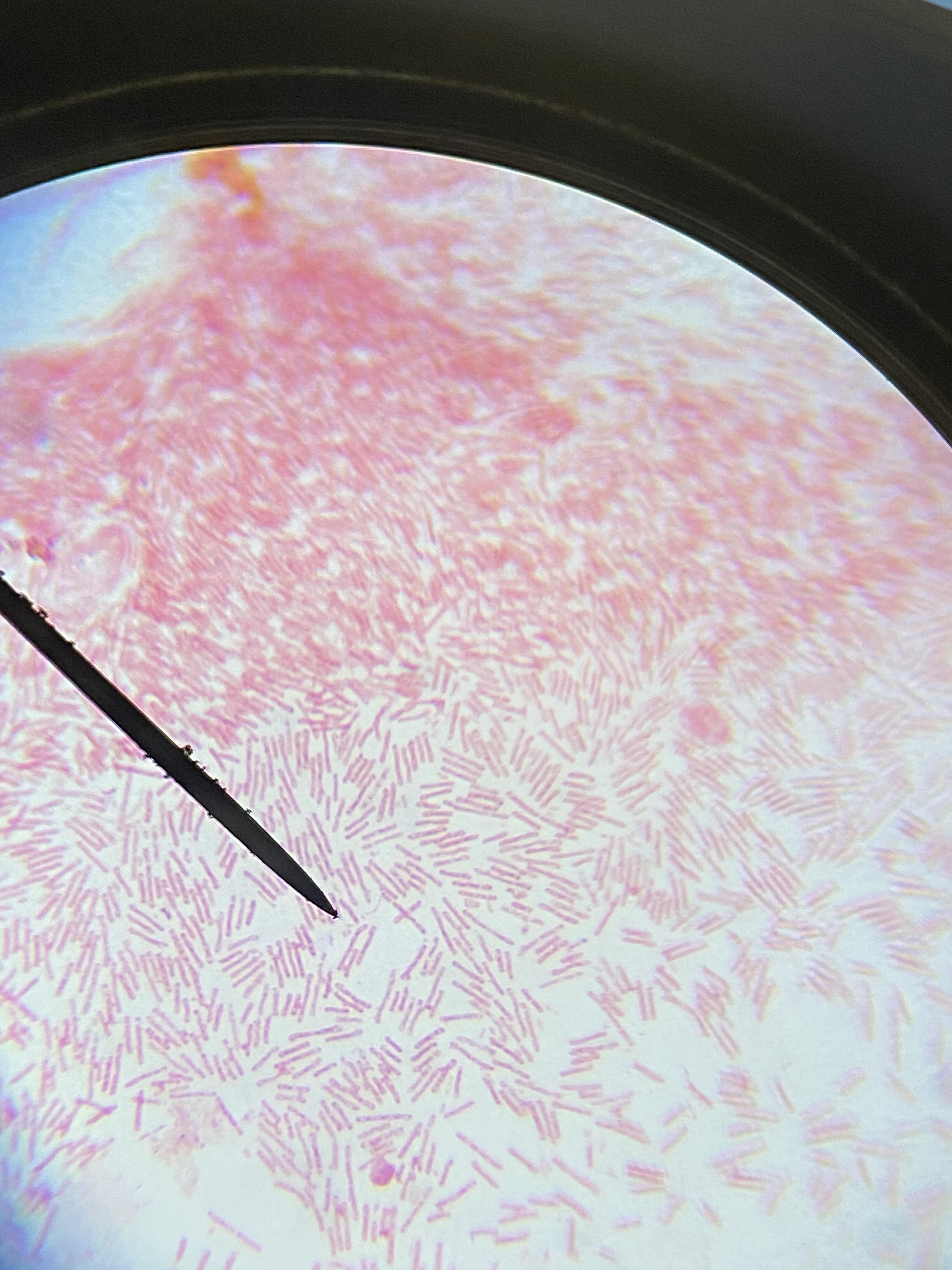Some bacteria from a biofilm in my fish tank. Decided to gram stain it