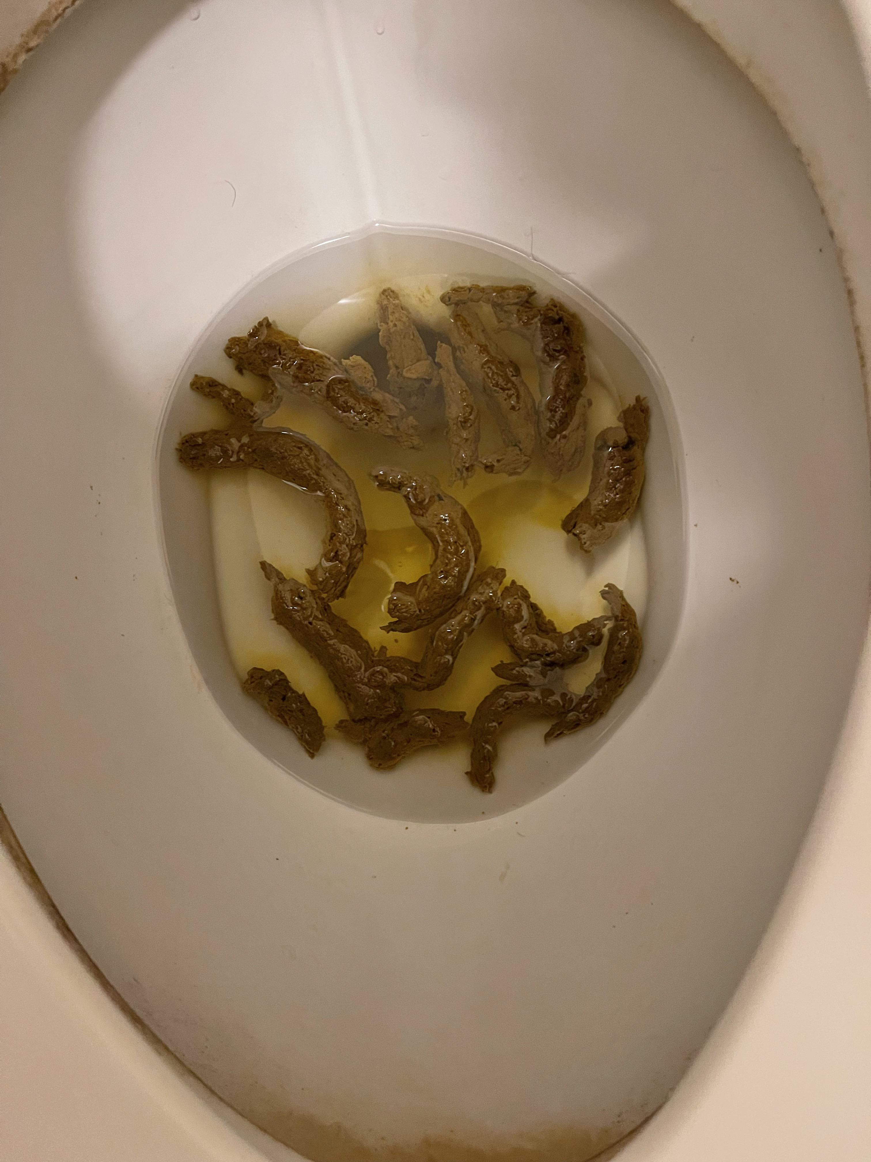 Why am I so inconsistent with bowel movements?! One day I’ll have a