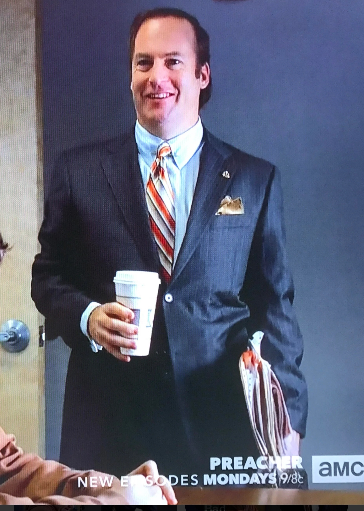 Why does Saul Goodman, in Breaking Bad, have a so fucking big forehead