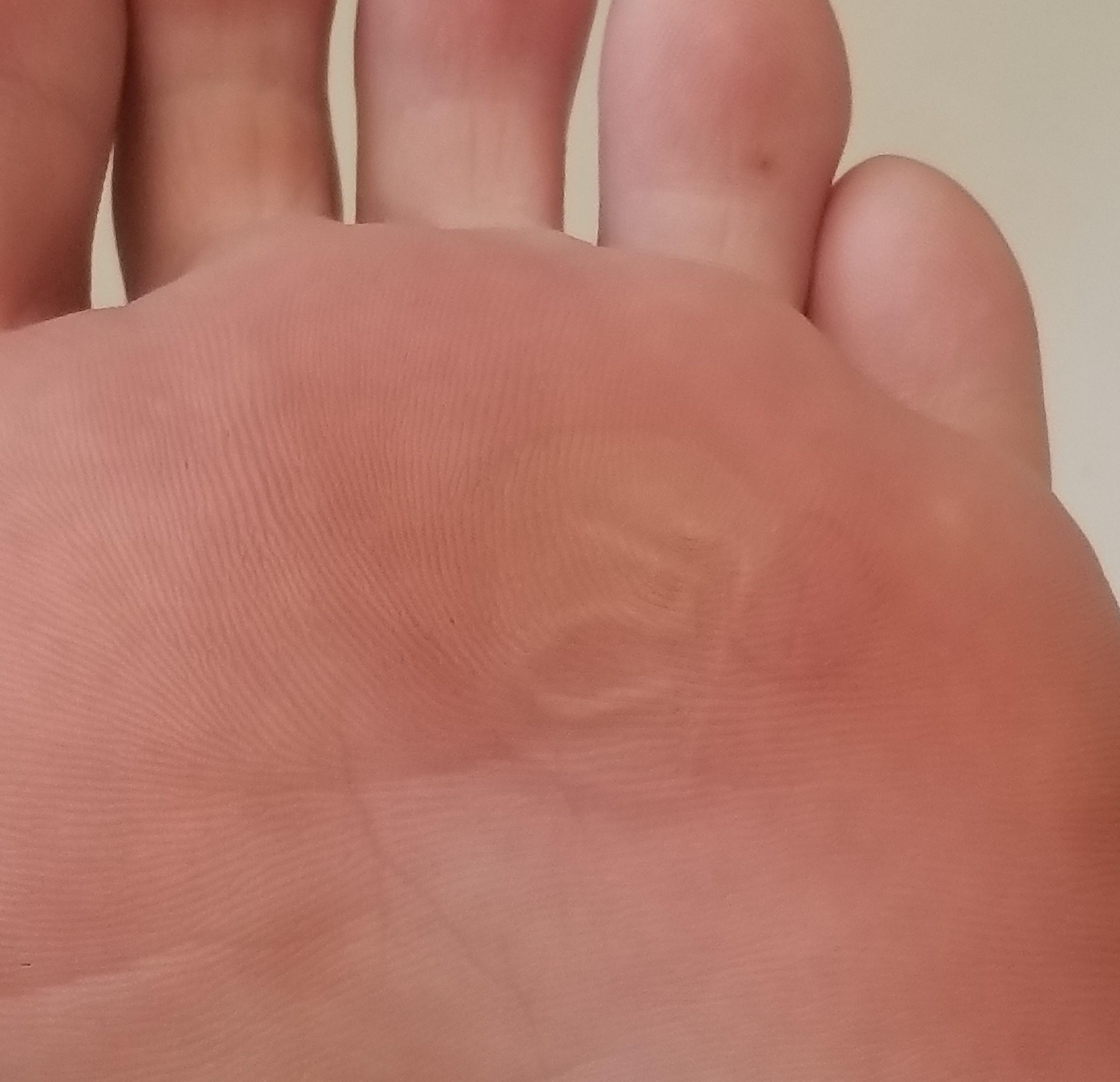My blister healed, now my foot print has a 5 r/mildlyinteresting