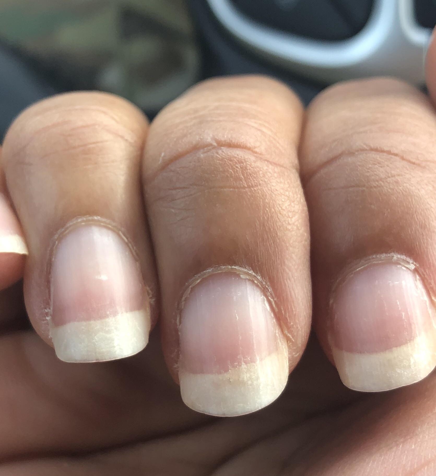Waves in nails? I tried to capture them as best I can but what causes