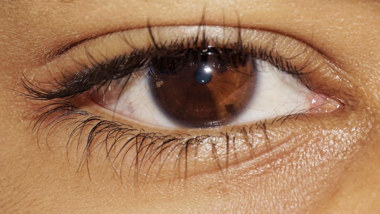 My brown /light brown eye sectoral heterocromia r/eyes