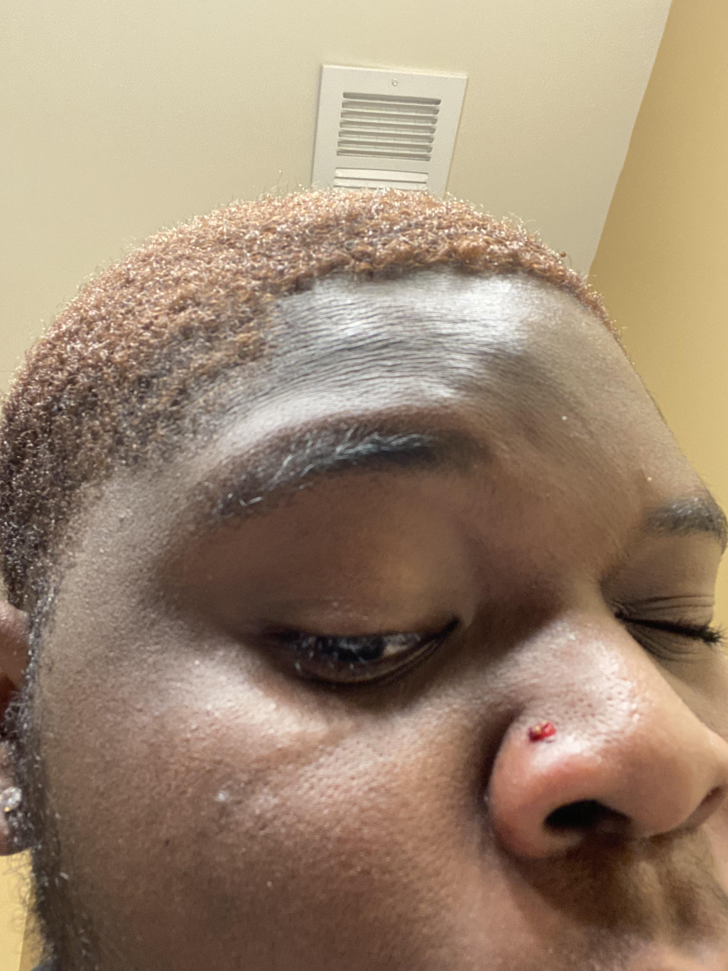 What’s wrong with my nose piercing and should I remove it, it won’t