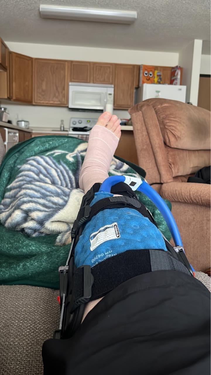 Surgery r/ACL