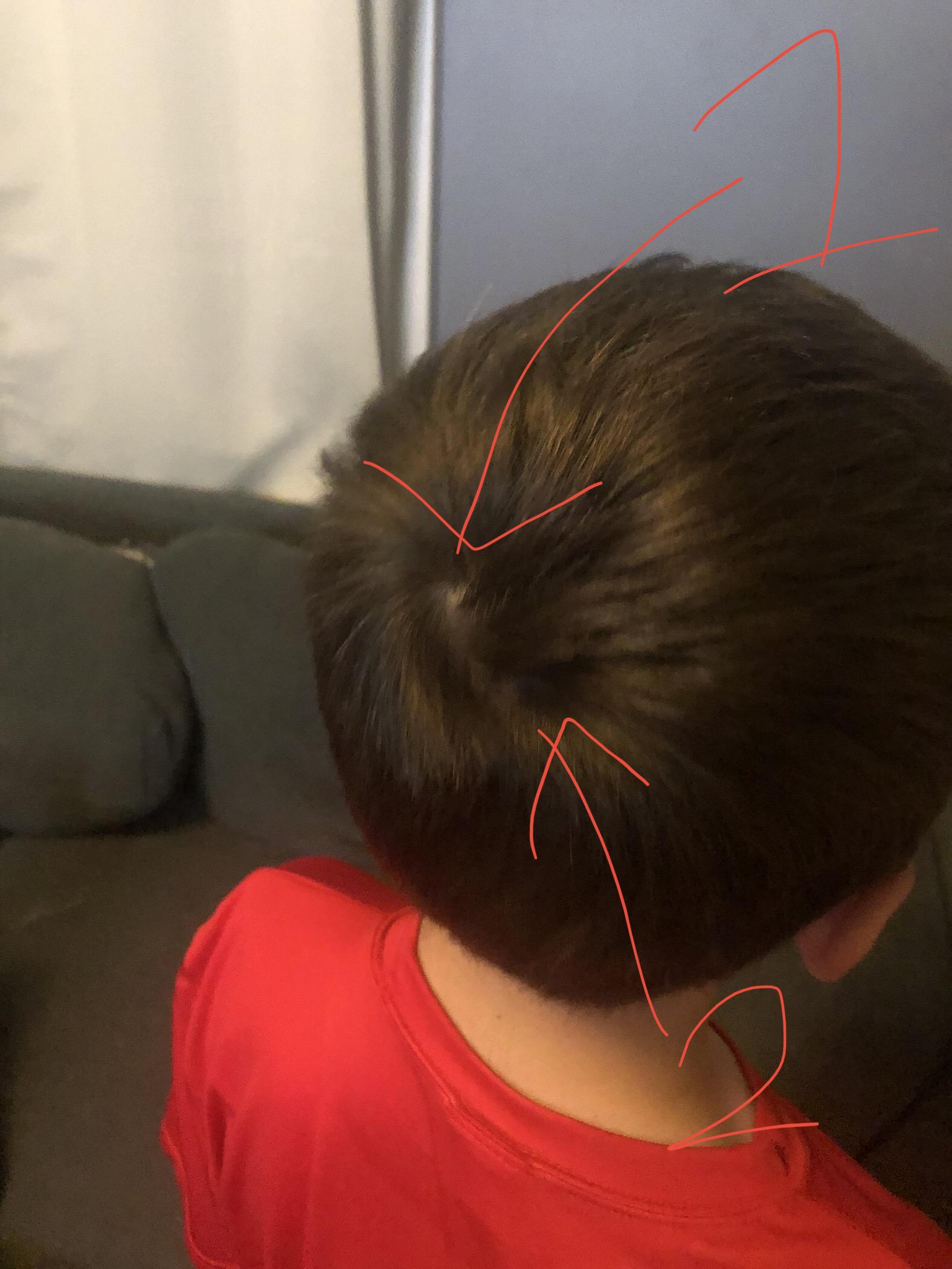 hey jack if you think that your singular anticlockwise hair whorl is