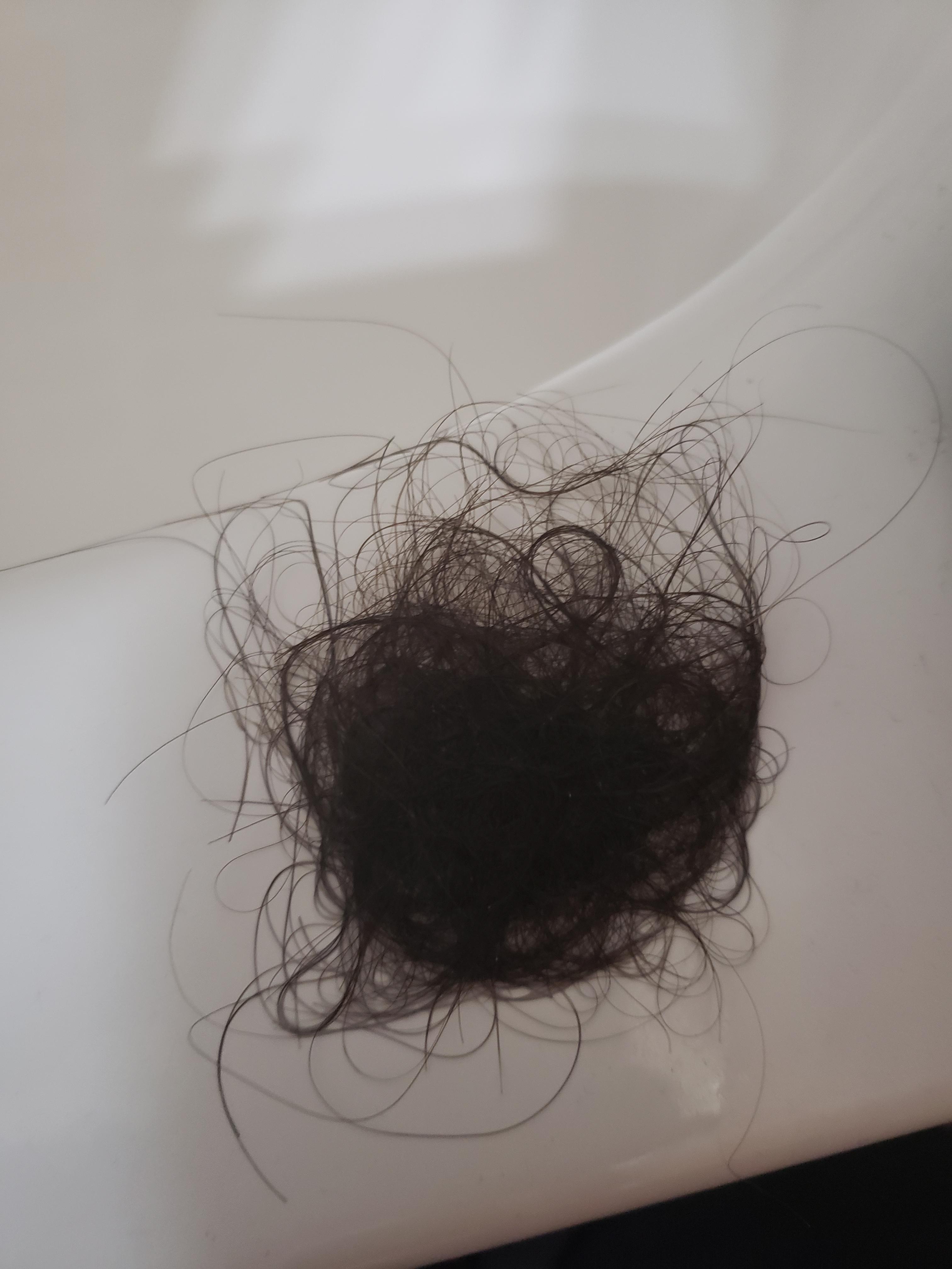 I wash my hair every 4 days....is this much loss normal?! r