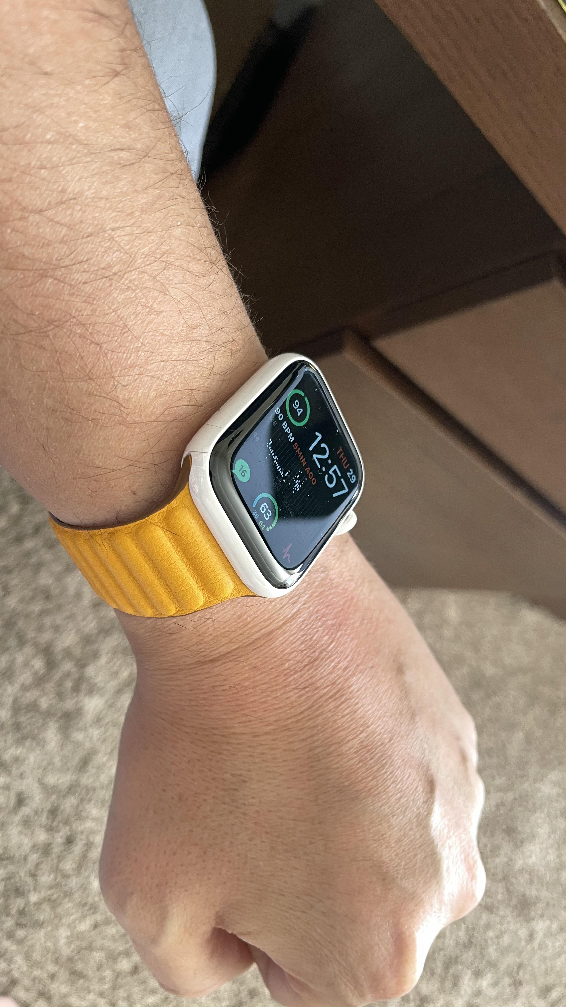 Had to go Ceramic due to a metal allergy r/AppleWatch