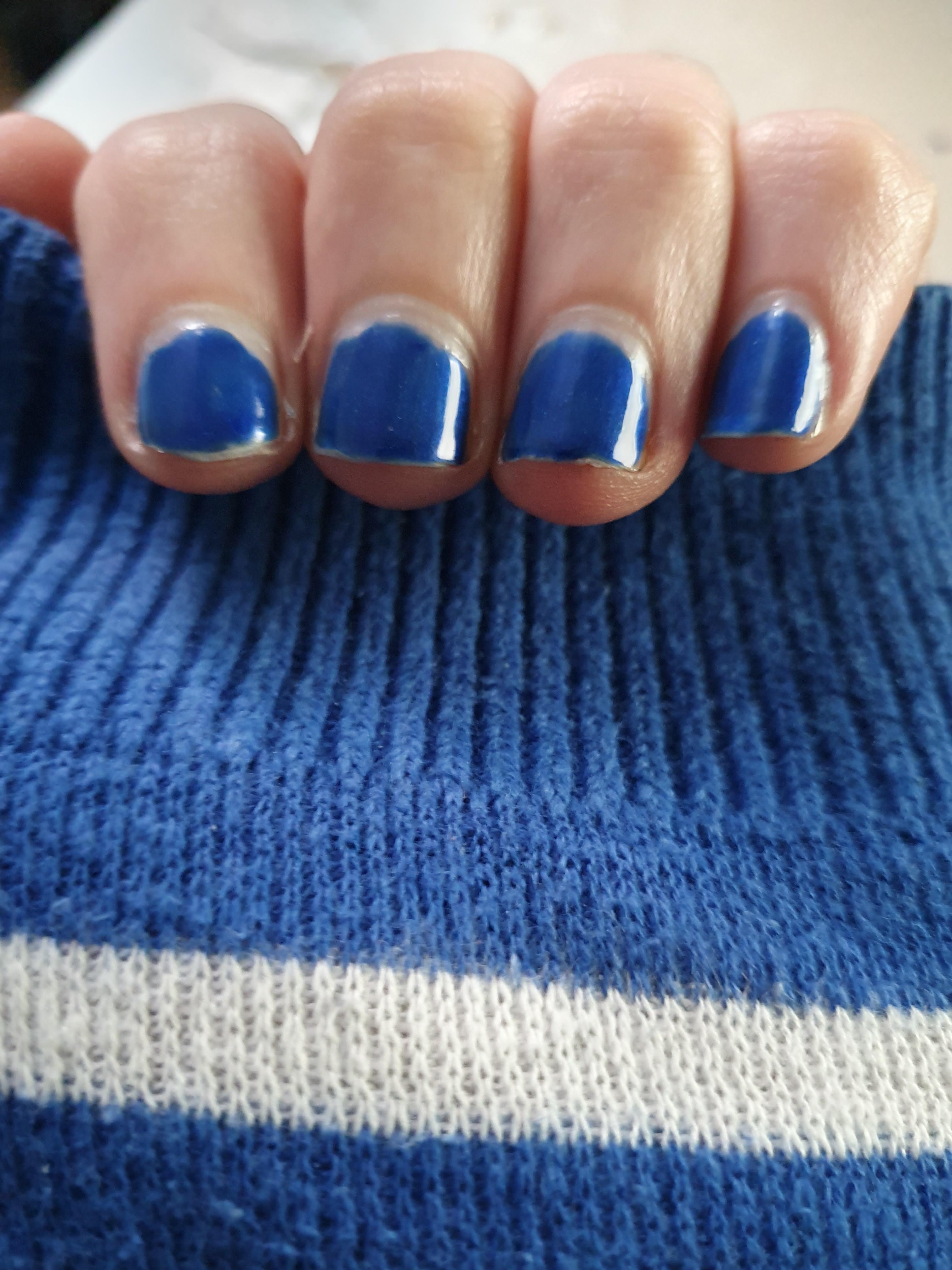 Top more than 123 nails getting blue latest songngunhatanh.edu.vn