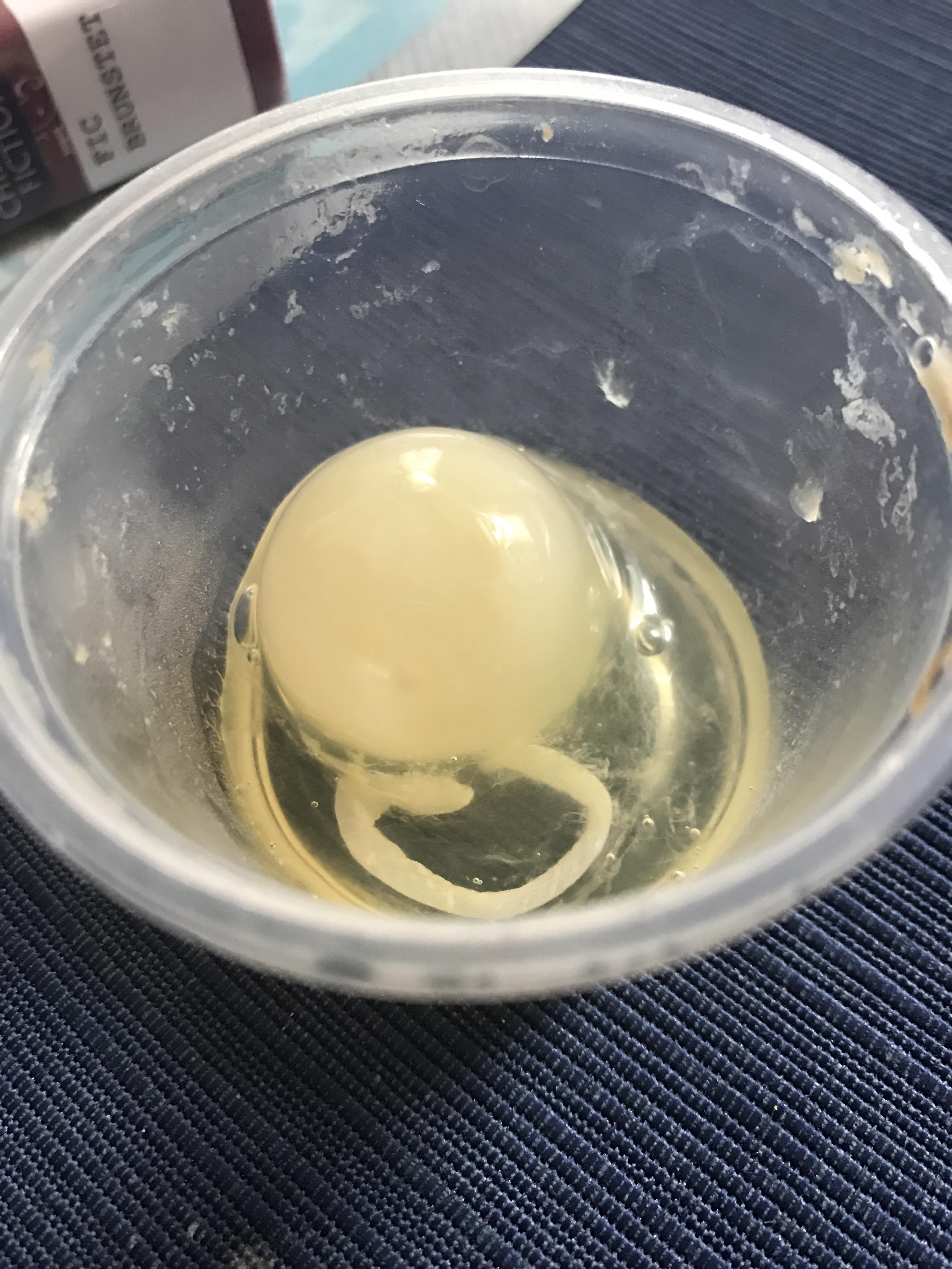 My grandmother found a white egg yolk today mildlyinteresting