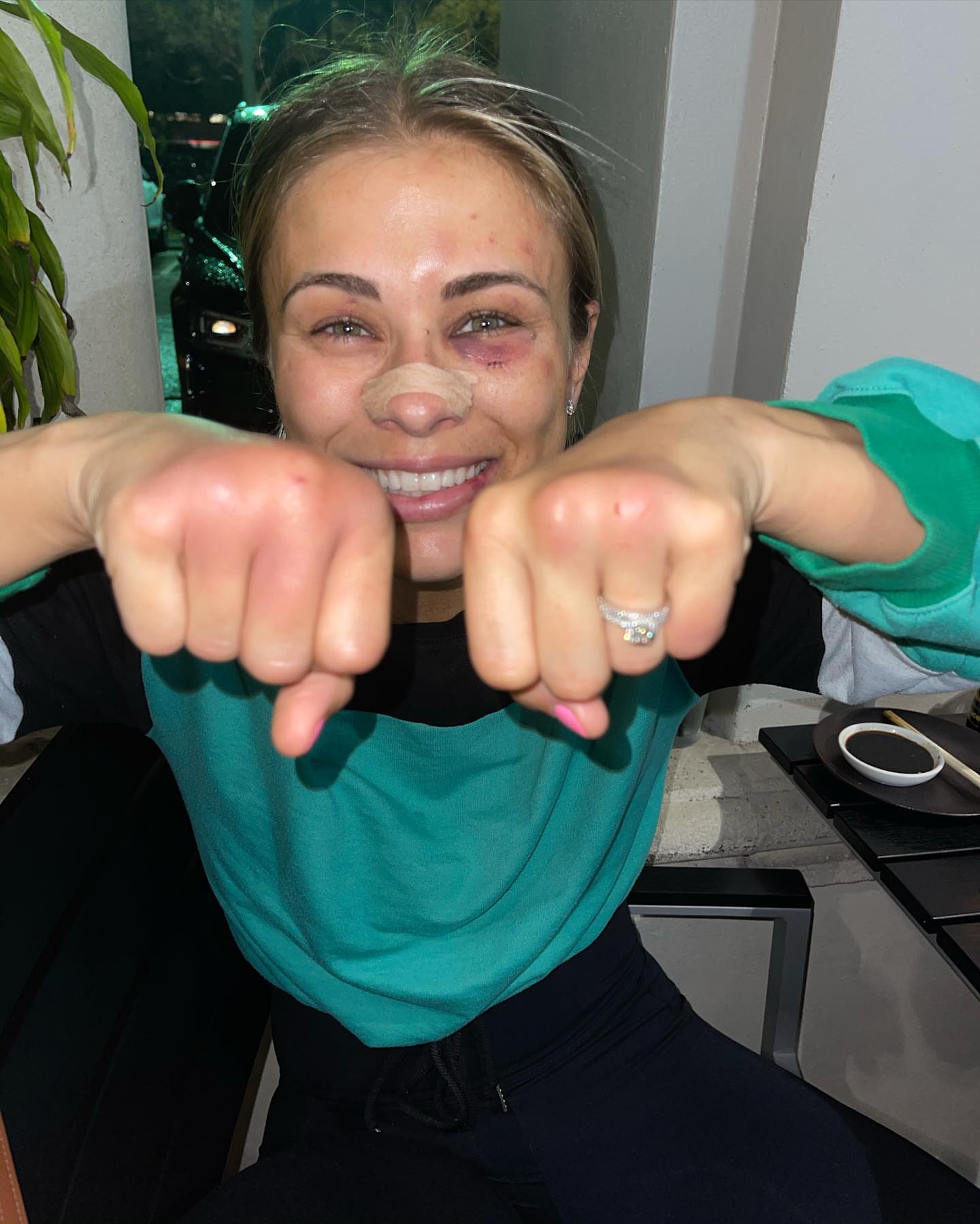 Paige VanZant's Bare Knuckles After Bare Knuckle Fighting r/WMMA
