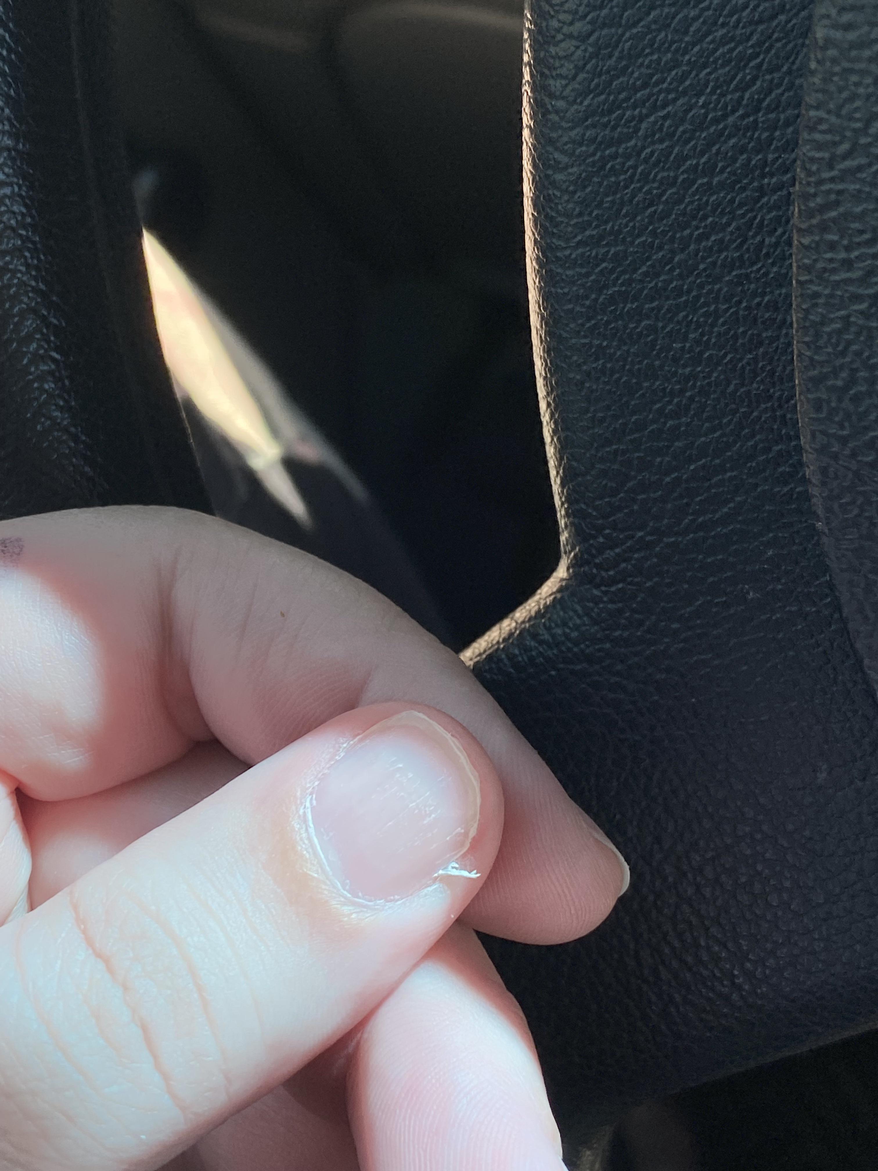 Please help my bad thumb picking habit!! The thumb on the right has