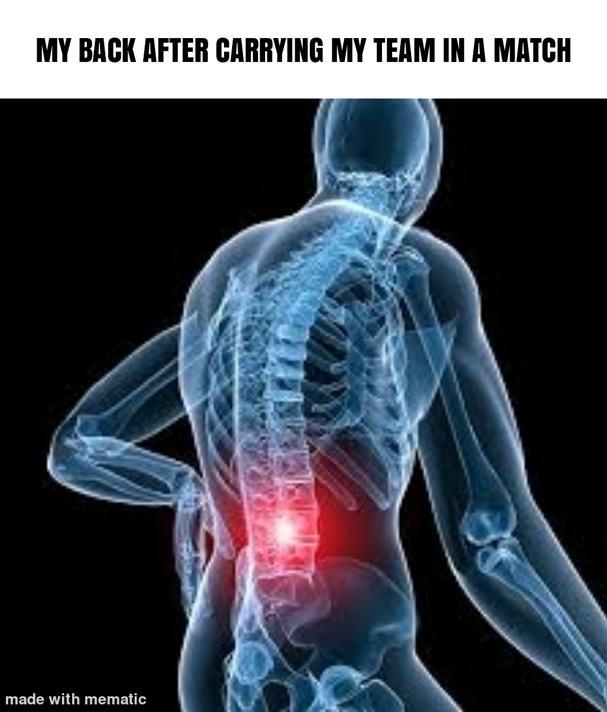 I got back pain 🥲 r/memes