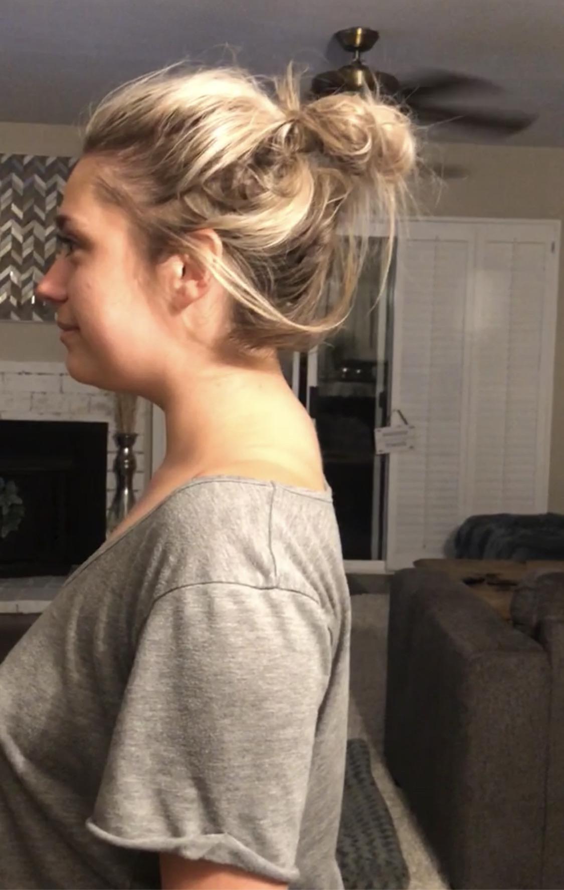 Does this look like a Buffalo hump? The fact that my spine and neck don